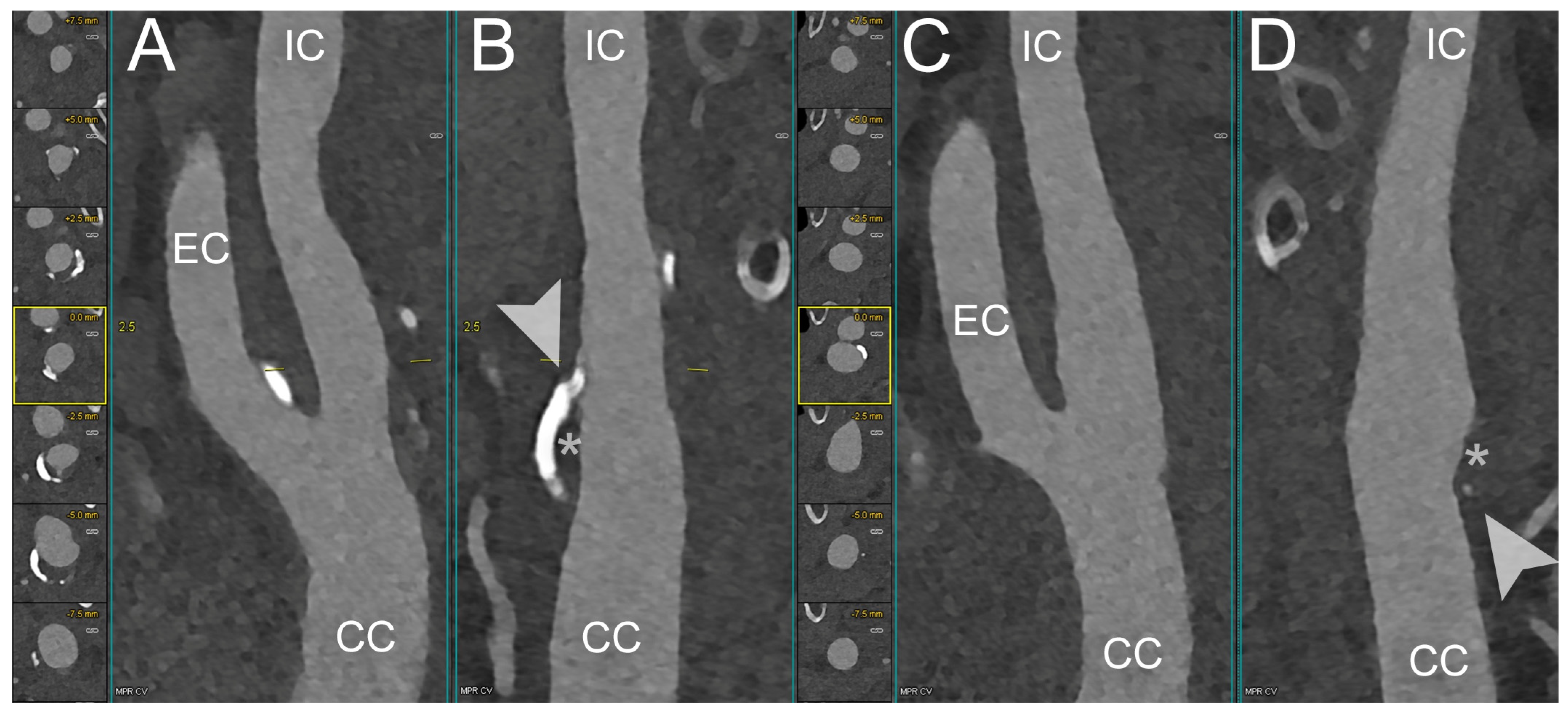 Diagnostics 14 01065 g003 Diagnostics 14 01065 g003