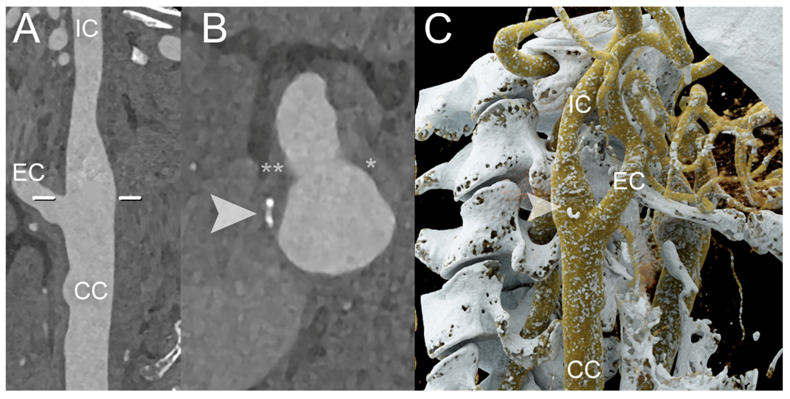 Diagnostics 14 01065 g004 Diagnostics 14 01065 g004