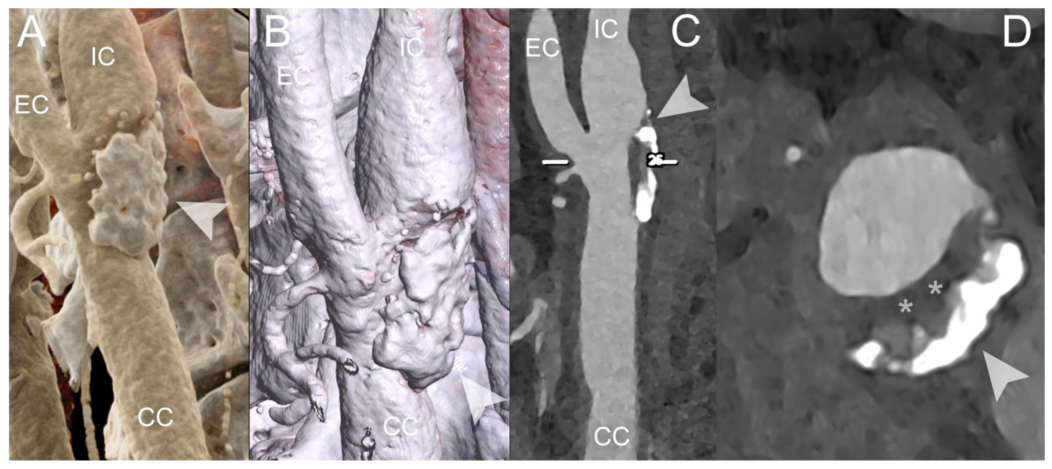 Diagnostics 14 01065 g005 Diagnostics 14 01065 g005
