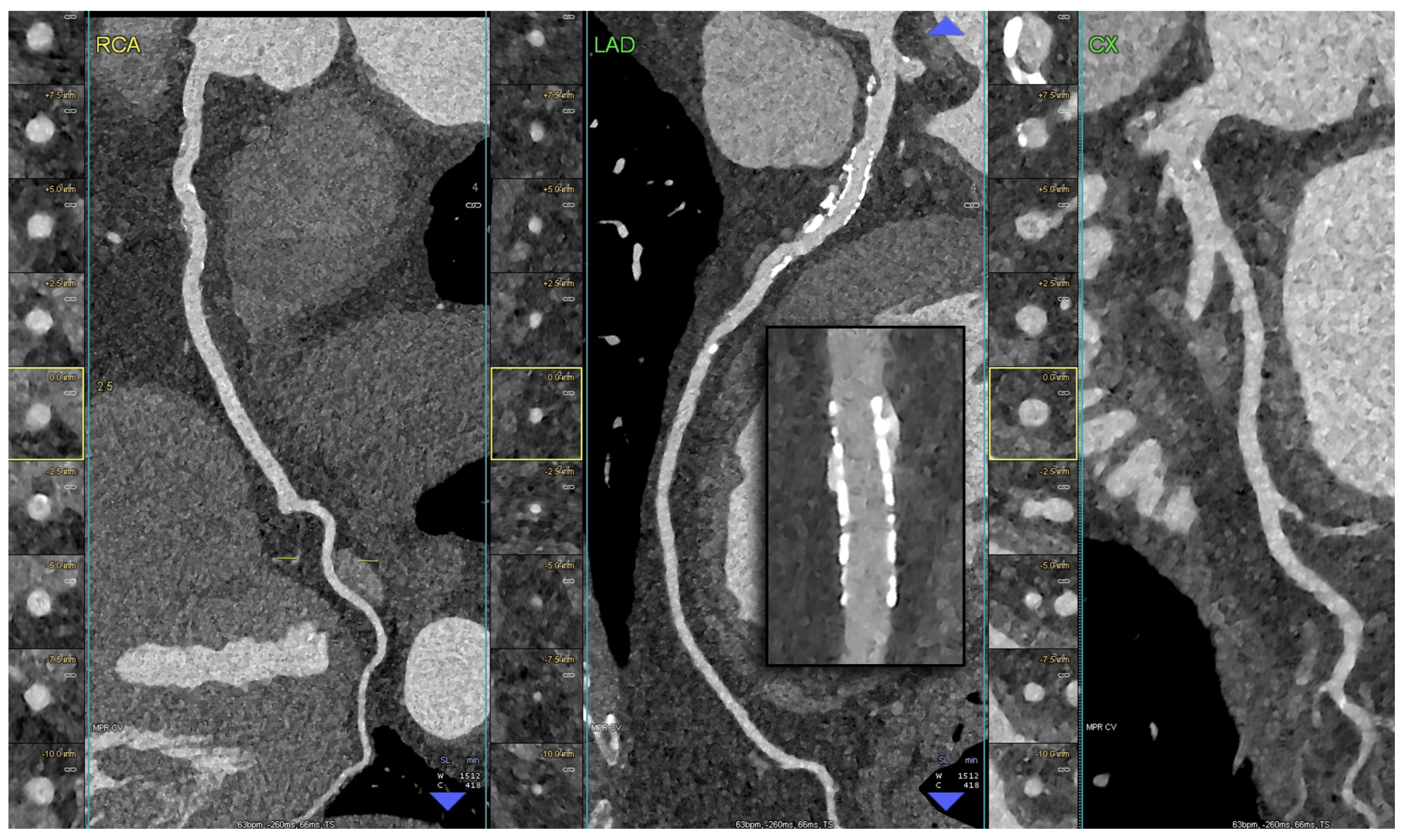 Diagnostics 14 01065 g006 Diagnostics 14 01065 g006