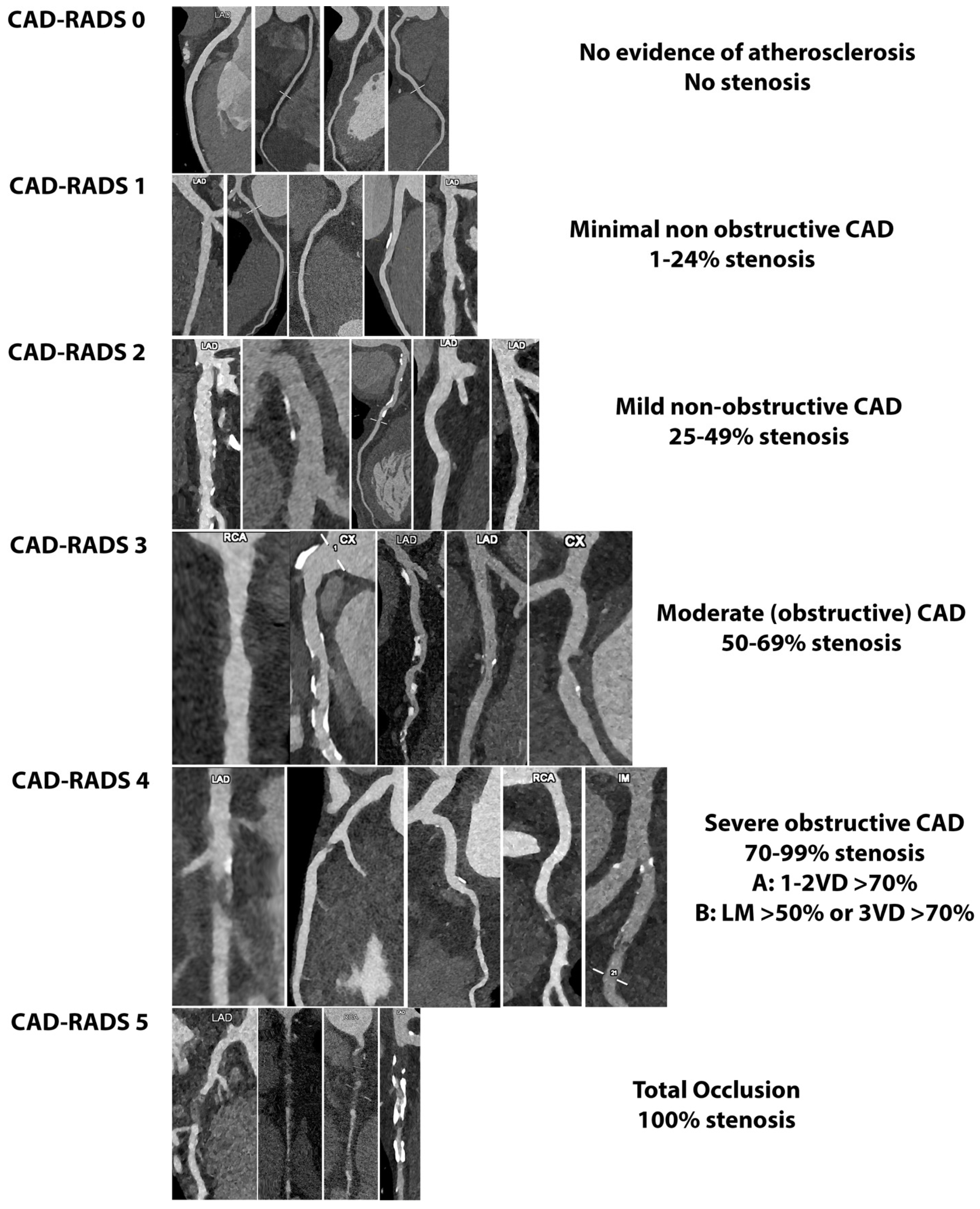 Diagnostics 14 01065 g008 Diagnostics 14 01065 g008