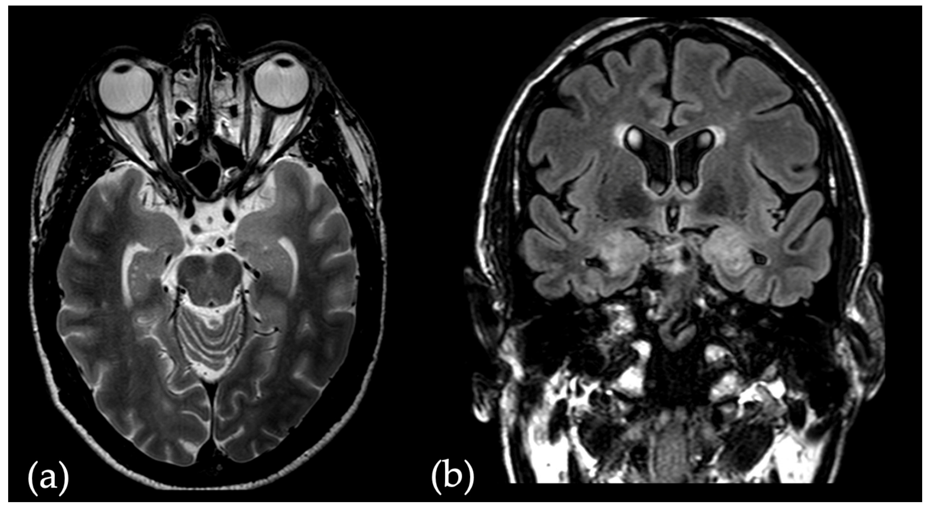 Diagnostics 14 01070 g001