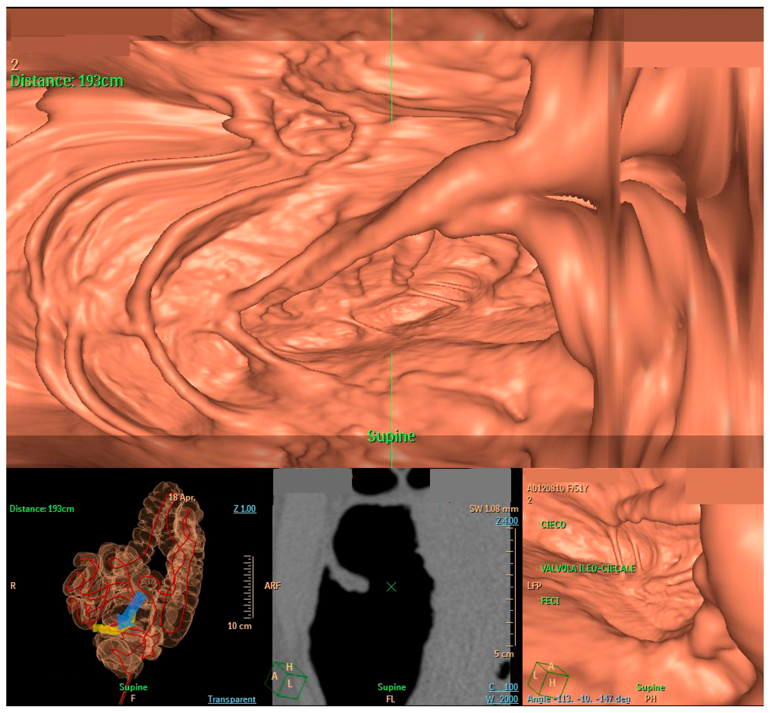 Diagnostics 14 01072 g002