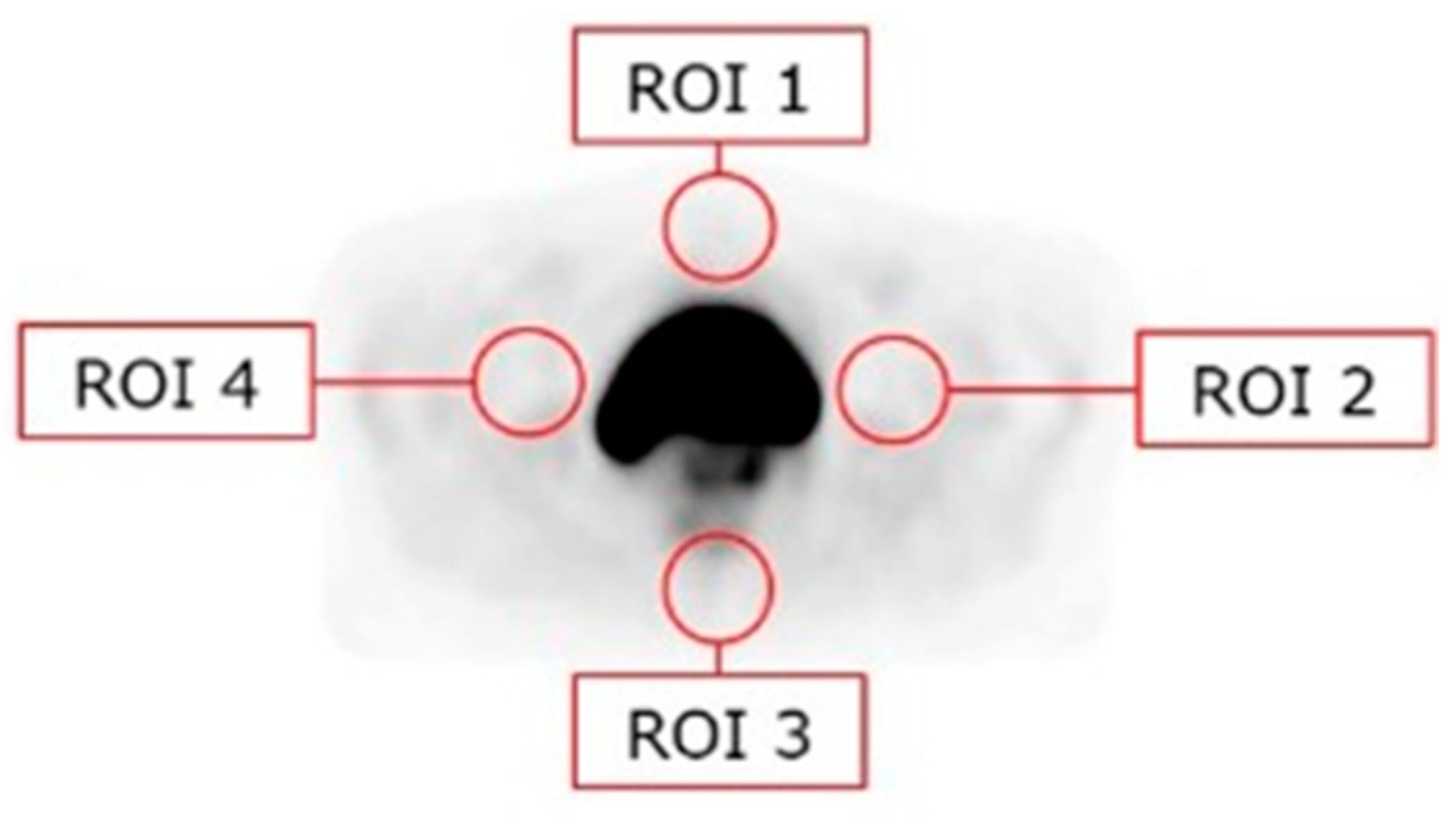 Diagnostics 14 01075 g001