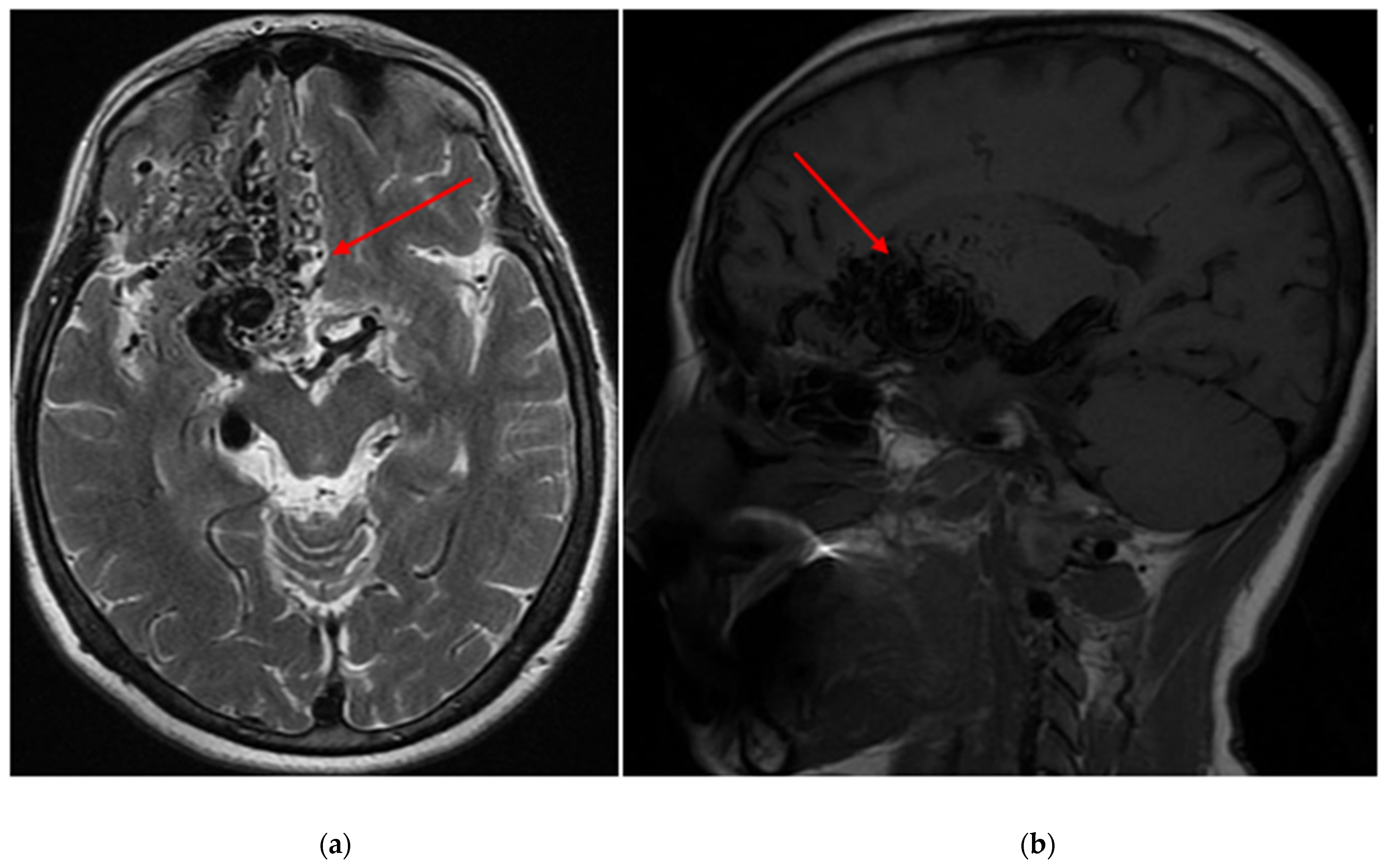Diagnostics 14 01077 g001
