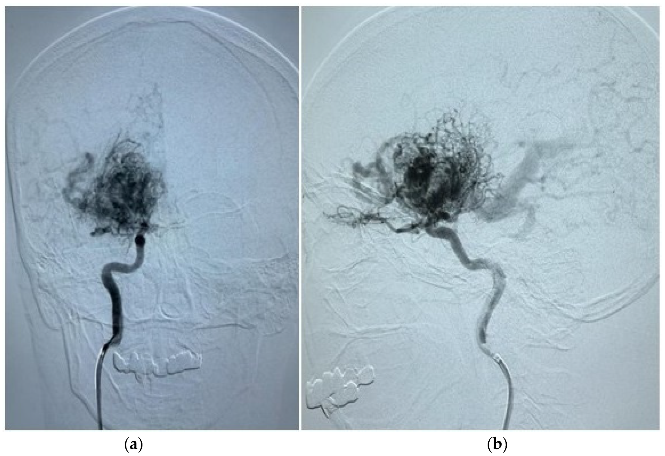 Diagnostics 14 01077 g002