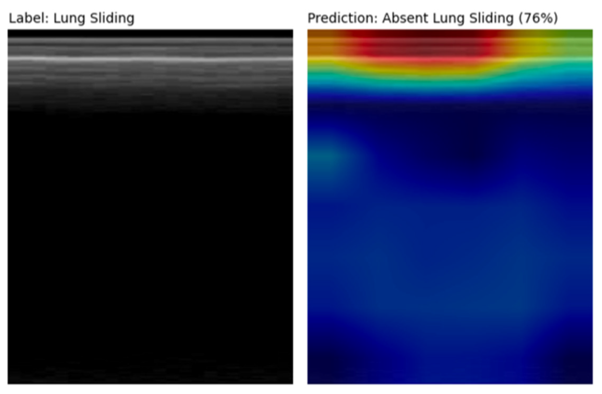 Diagnostics 14 01081 g007