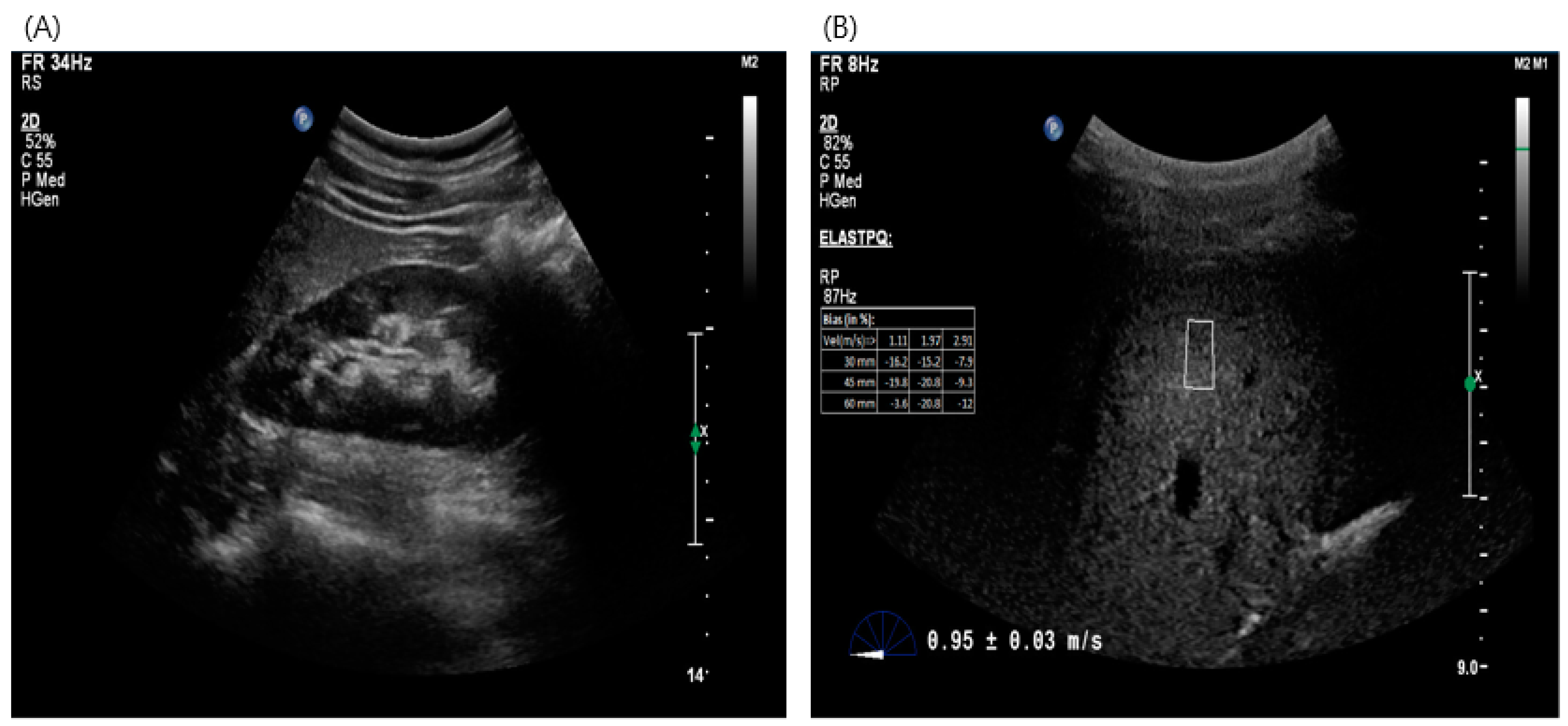 Diagnostics 14 01083 g002