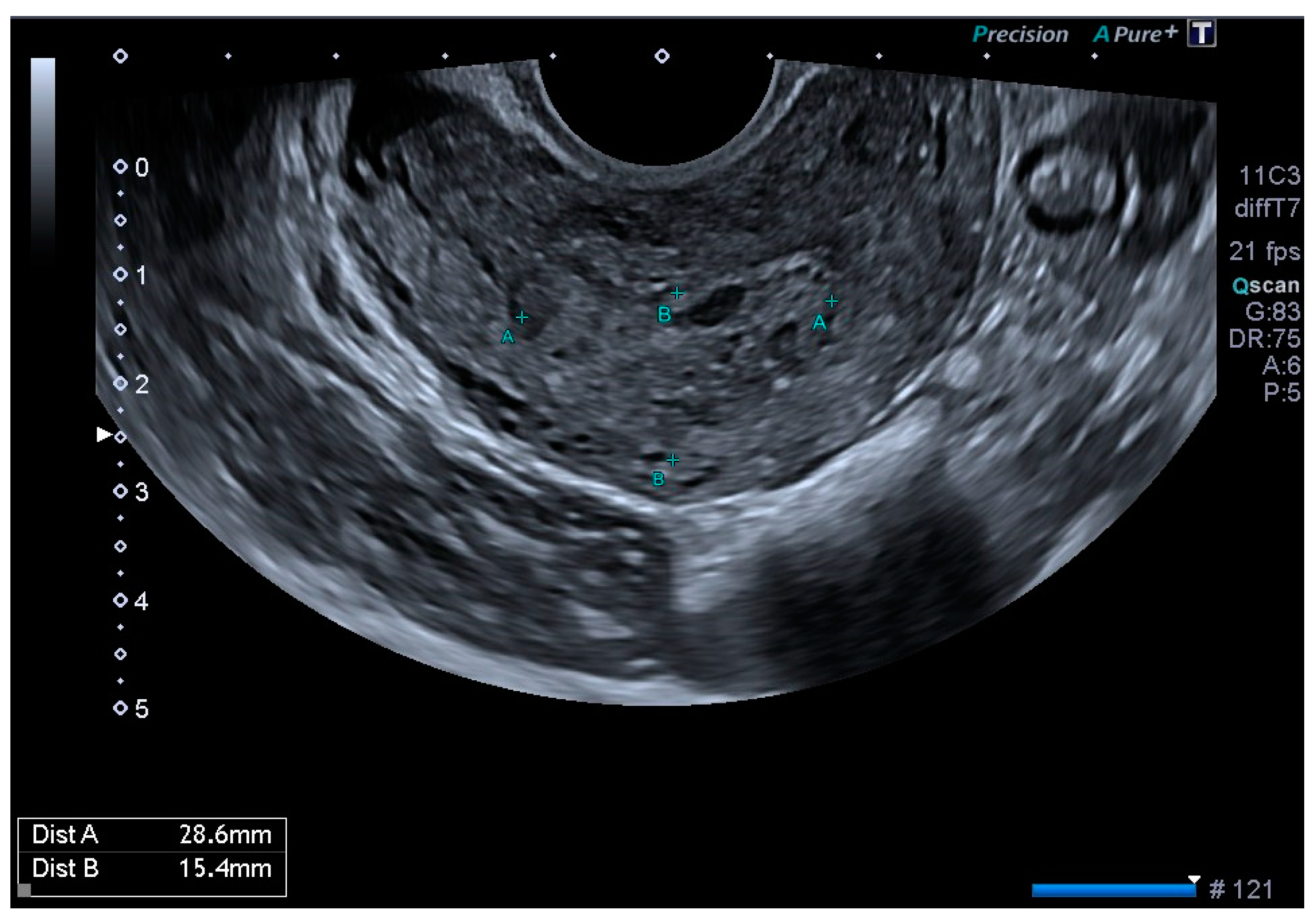 Diagnostics 14 01084 g001