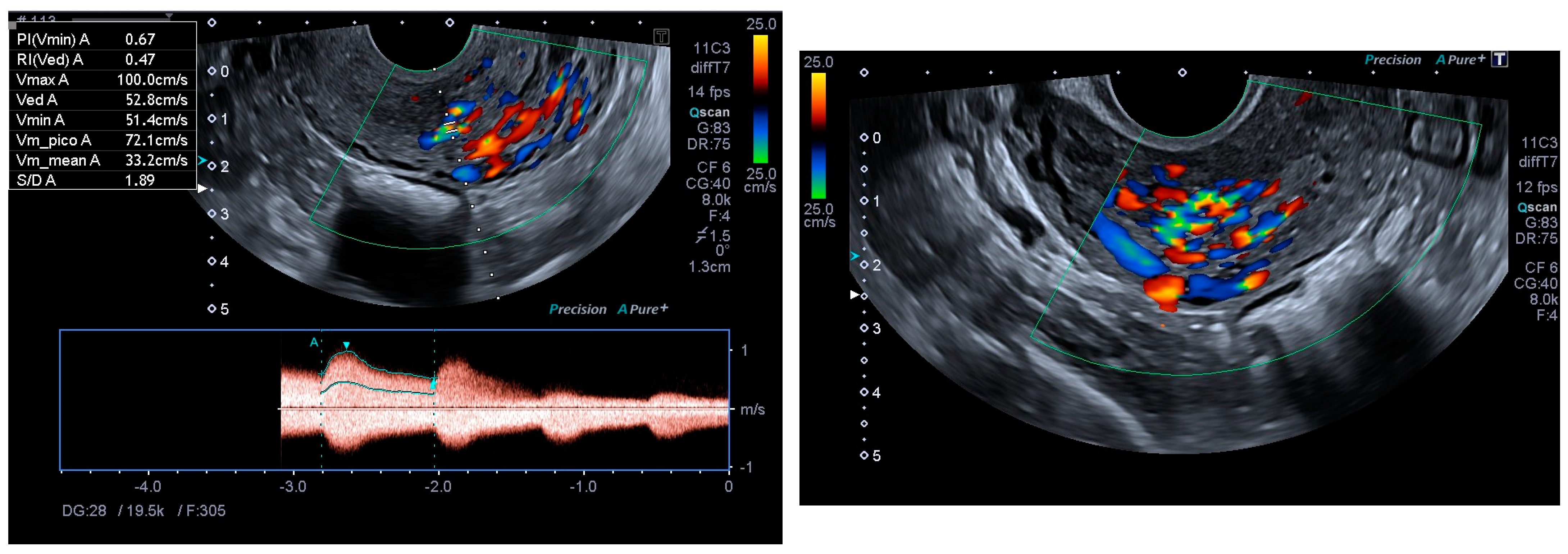 Diagnostics 14 01084 g002