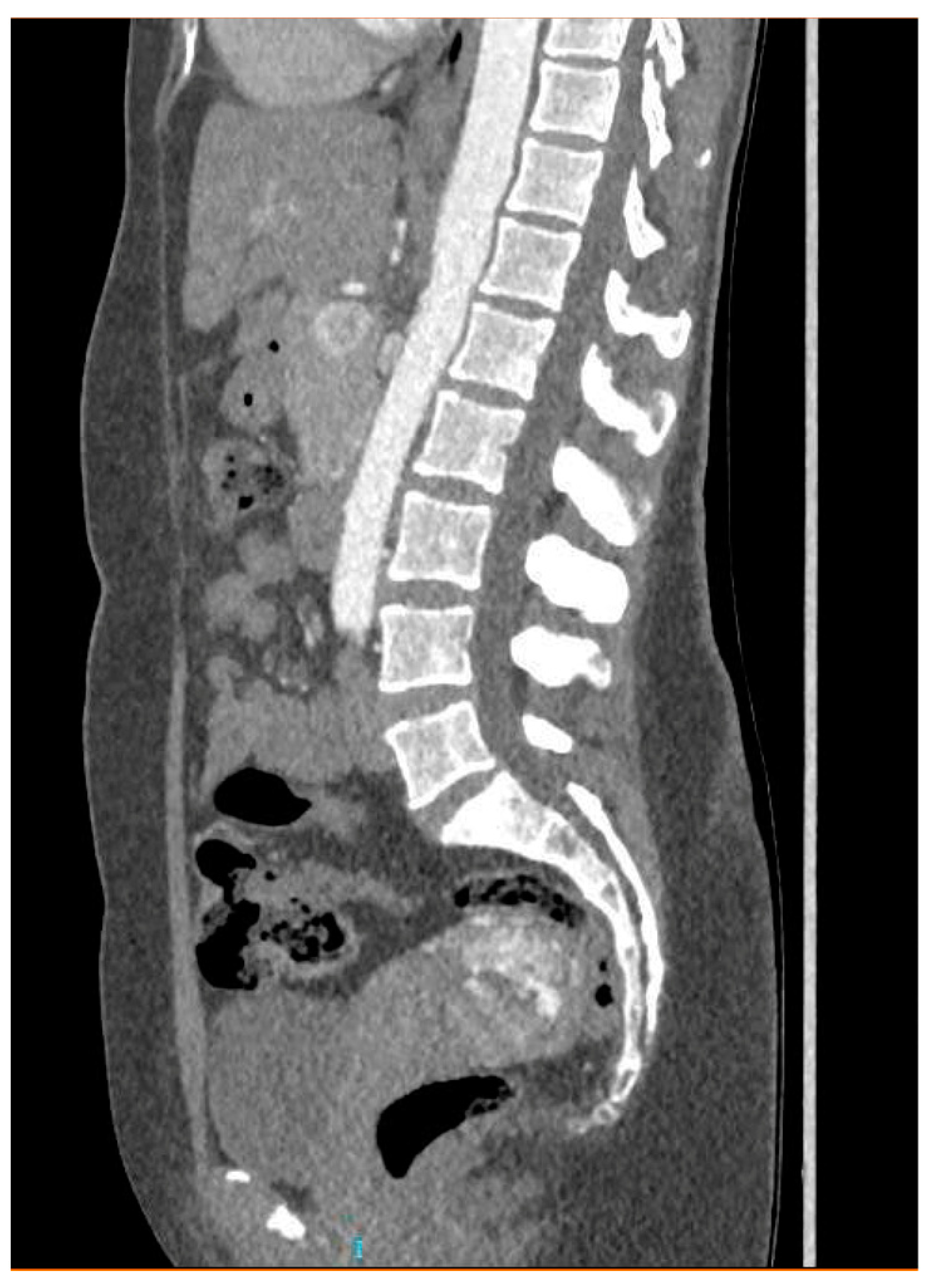 Diagnostics 14 01084 g004