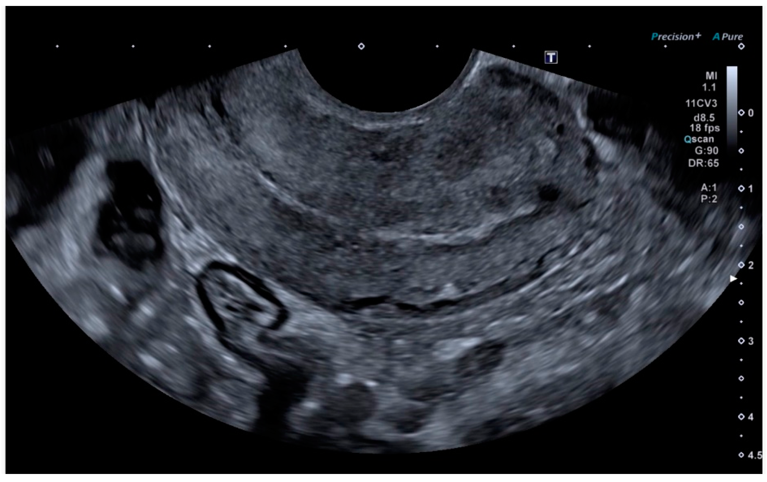 Diagnostics 14 01084 g005