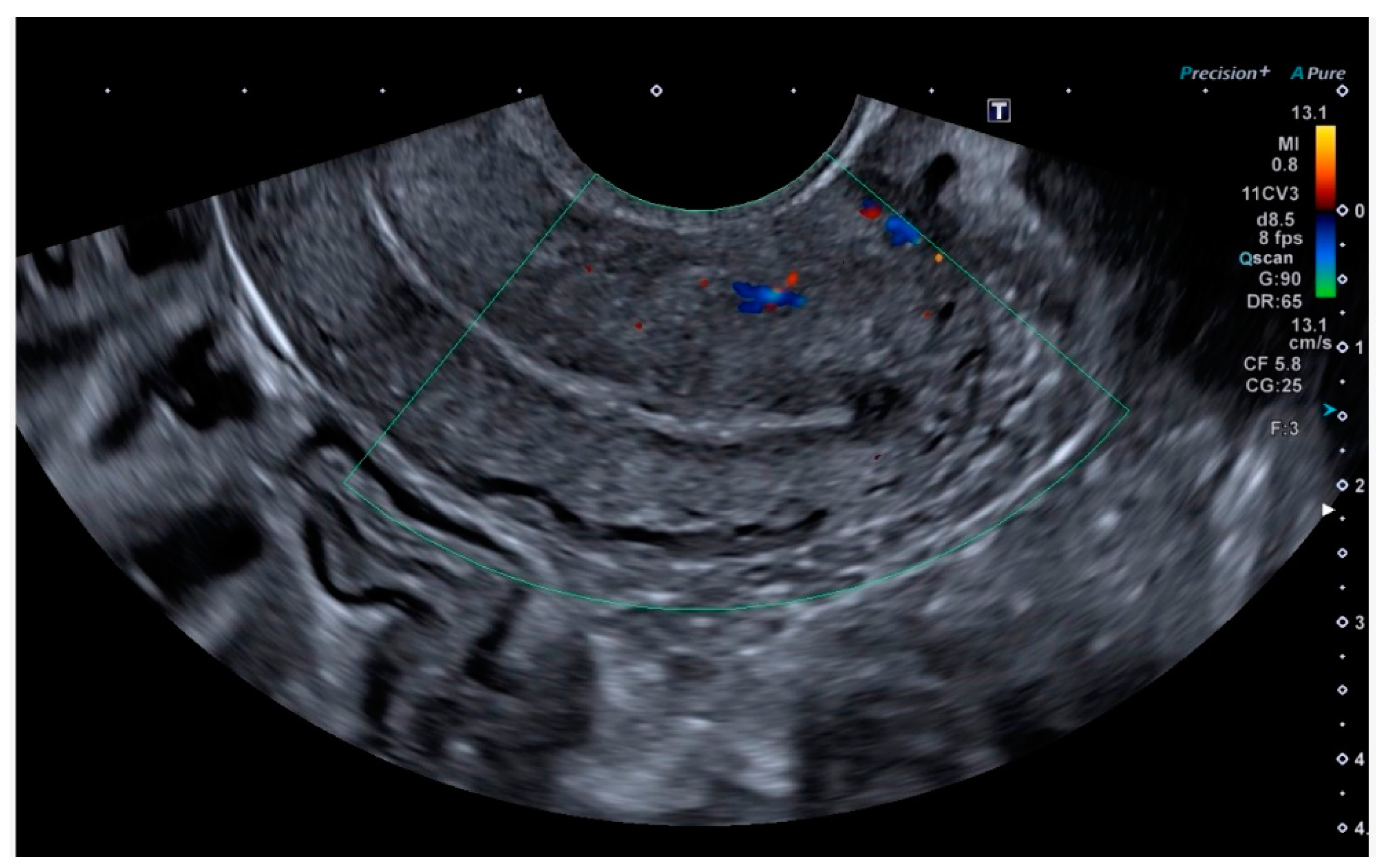 Diagnostics 14 01084 g006