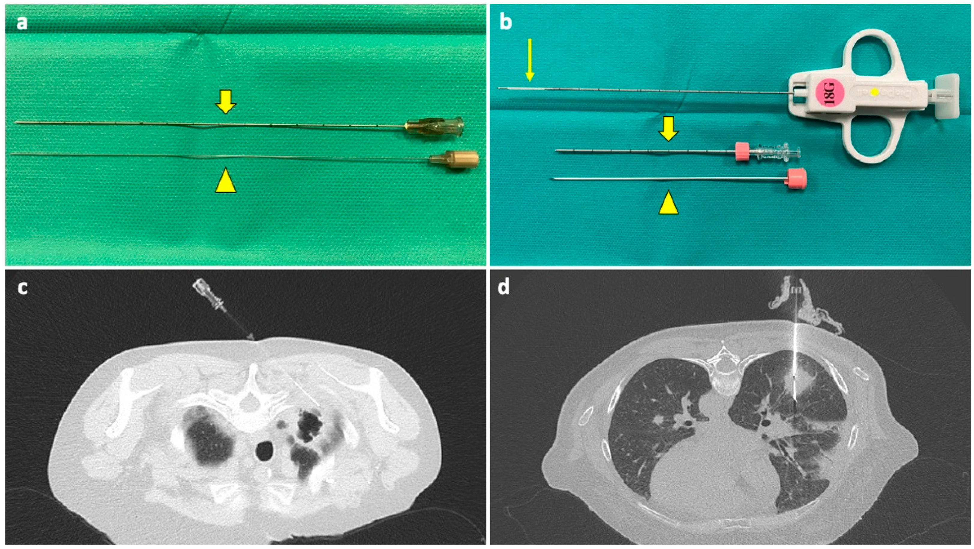 Diagnostics 14 01089 g001