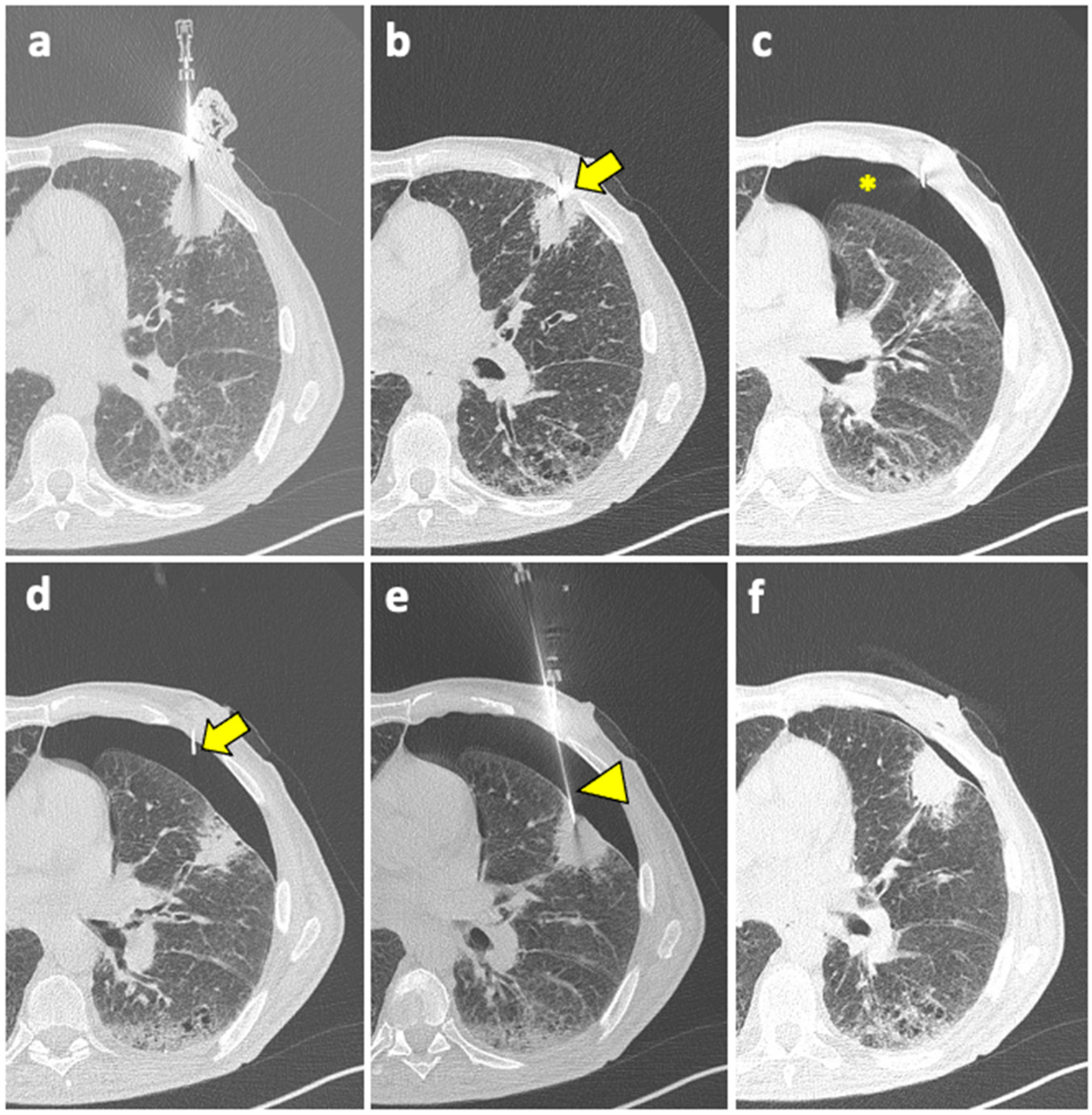 Diagnostics 14 01089 g002