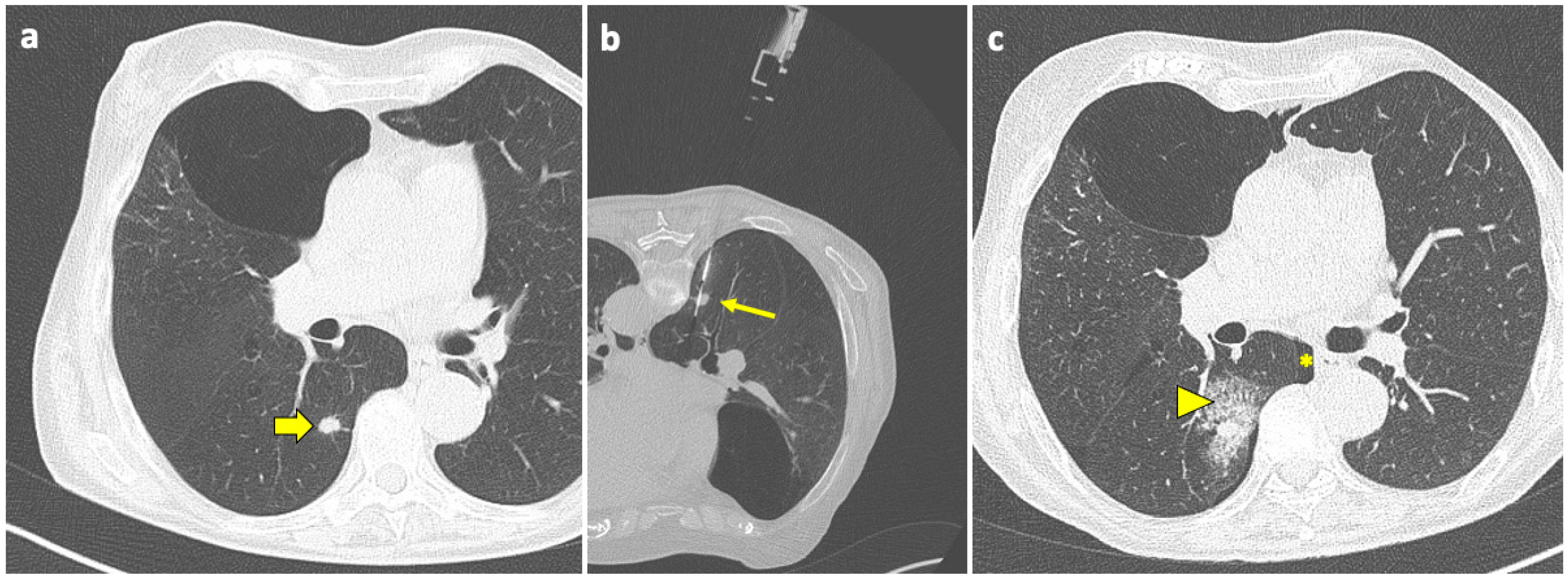 Diagnostics 14 01089 g003