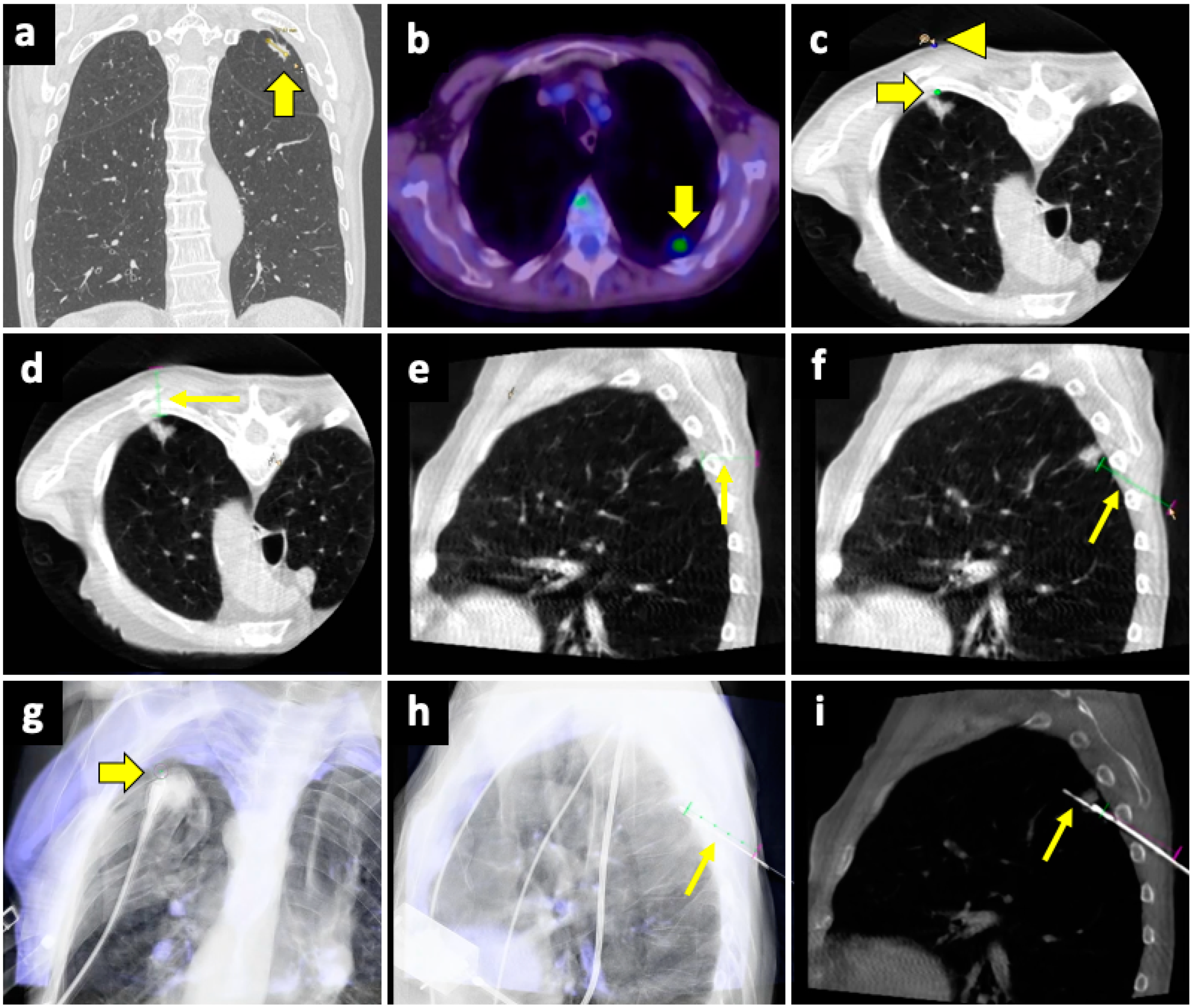 Diagnostics 14 01089 g004