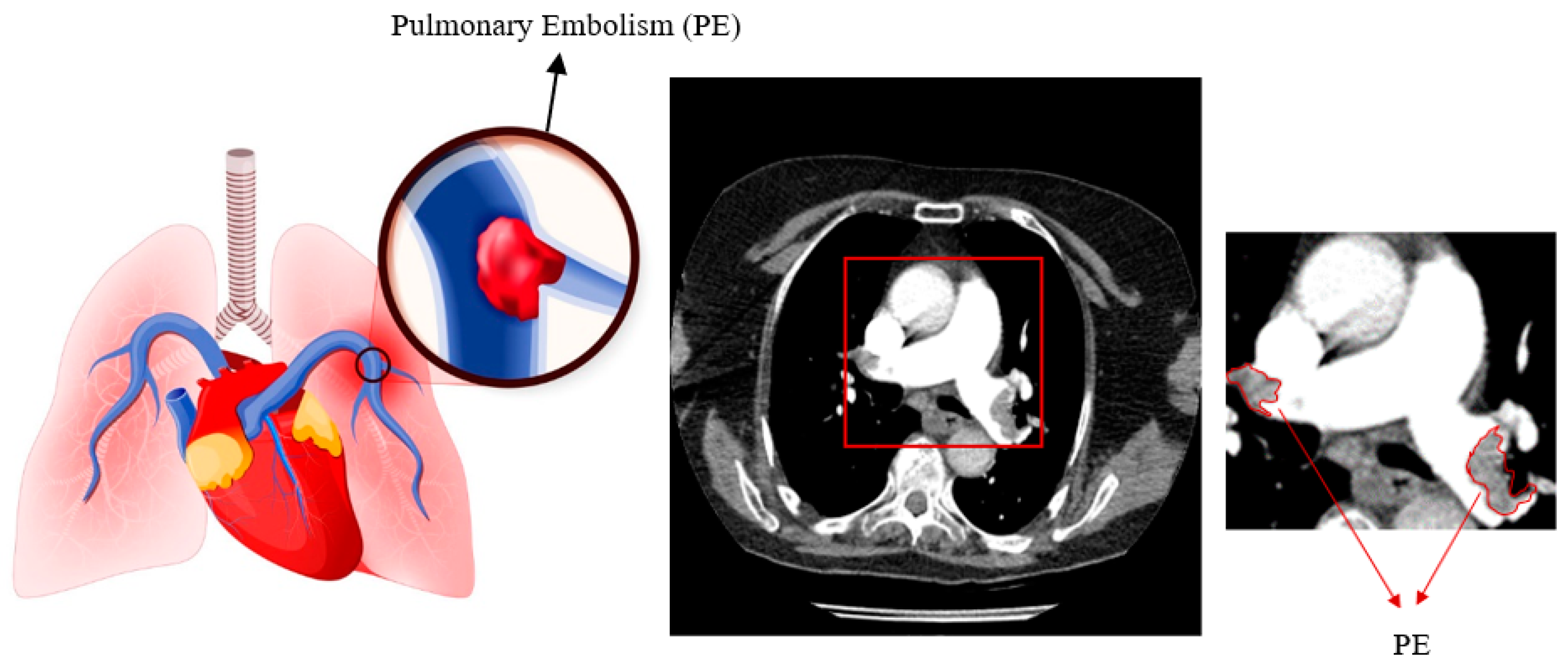 Diagnostics 14 01102 g001