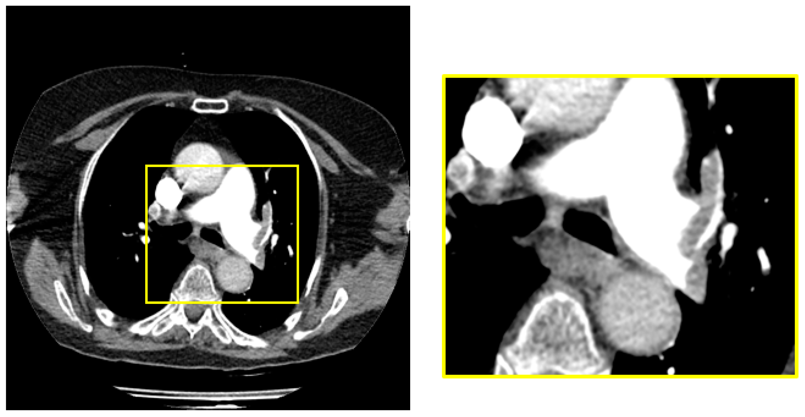 Diagnostics 14 01102 g002