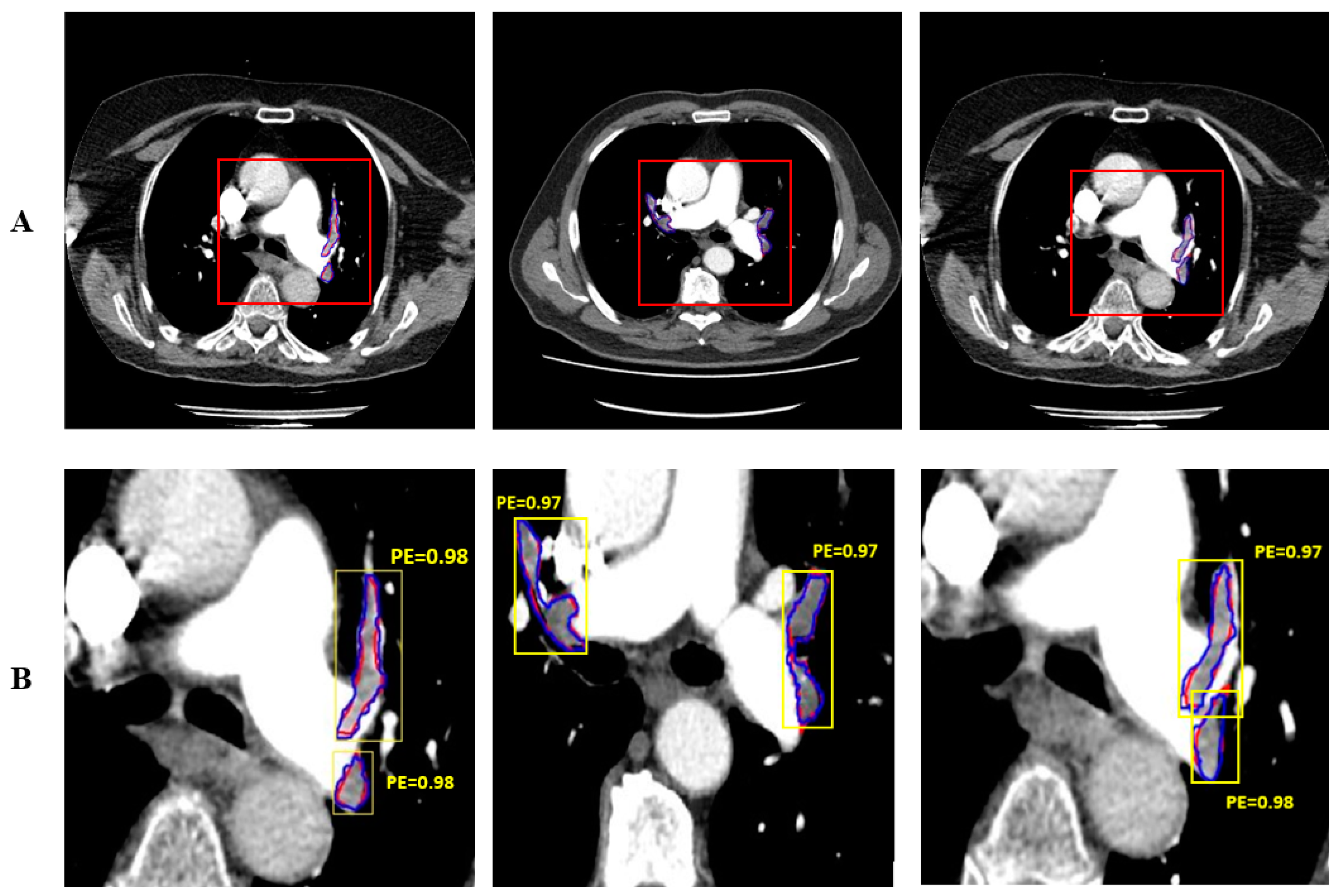 Diagnostics 14 01102 g006