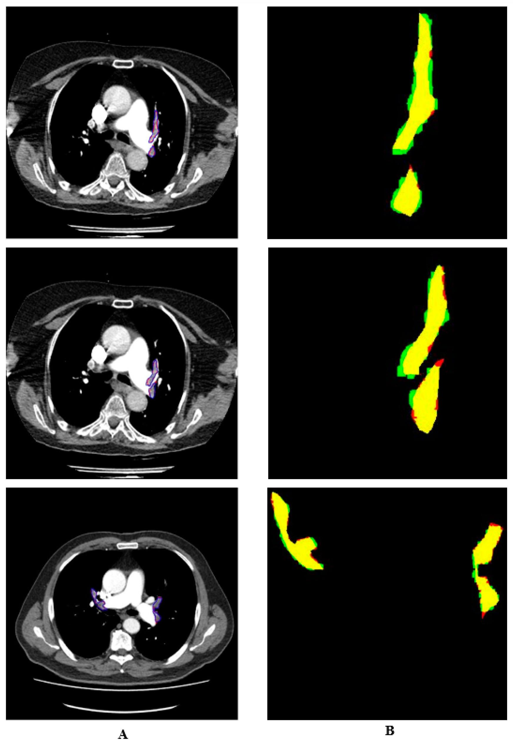 Diagnostics 14 01102 g007