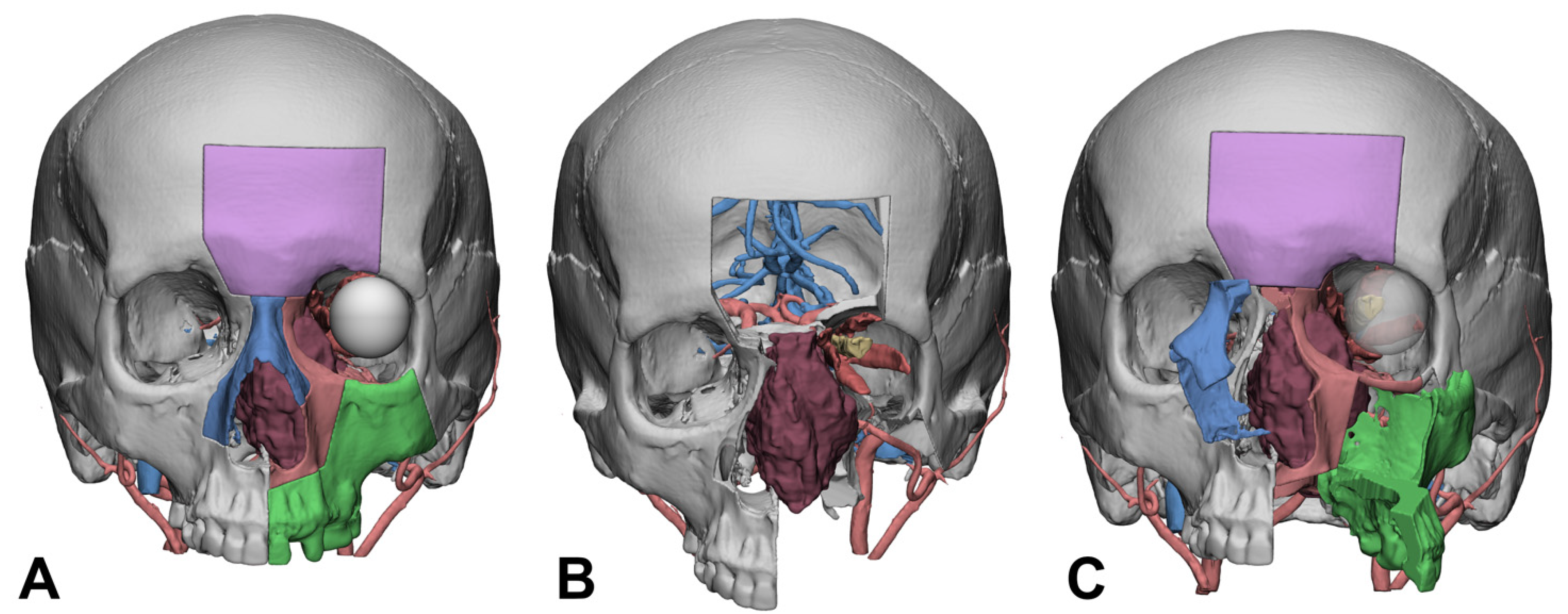 Diagnostics 14 01108 g001