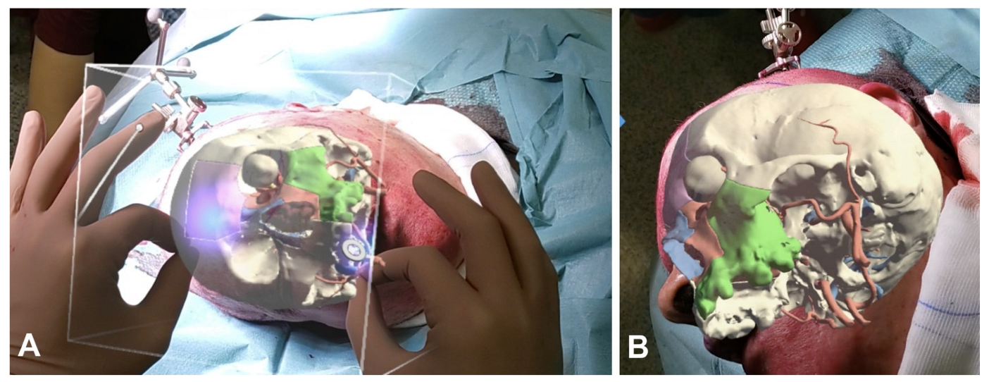 Diagnostics 14 01108 g002