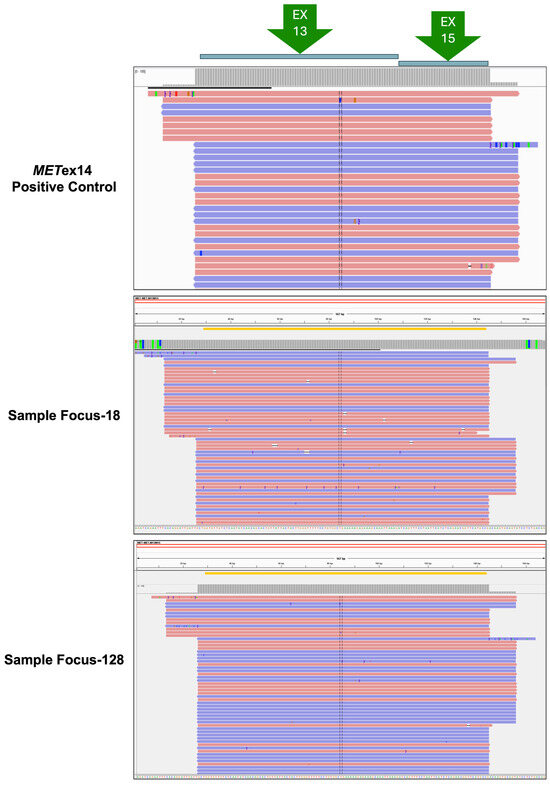 Retrospective Analysis to Optimize the Detection of MET Exon 14 ...