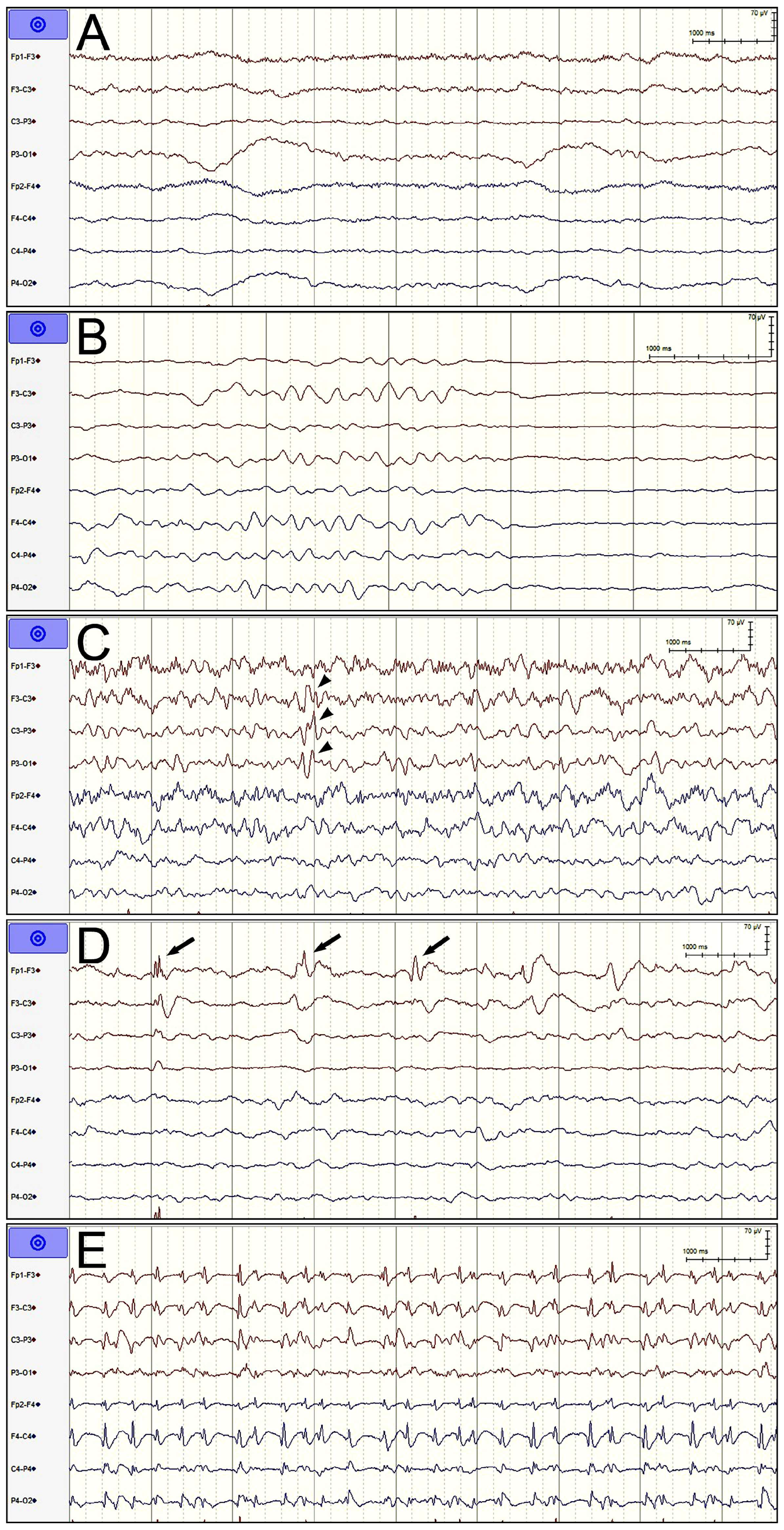 Diagnostics 14 01111 g001