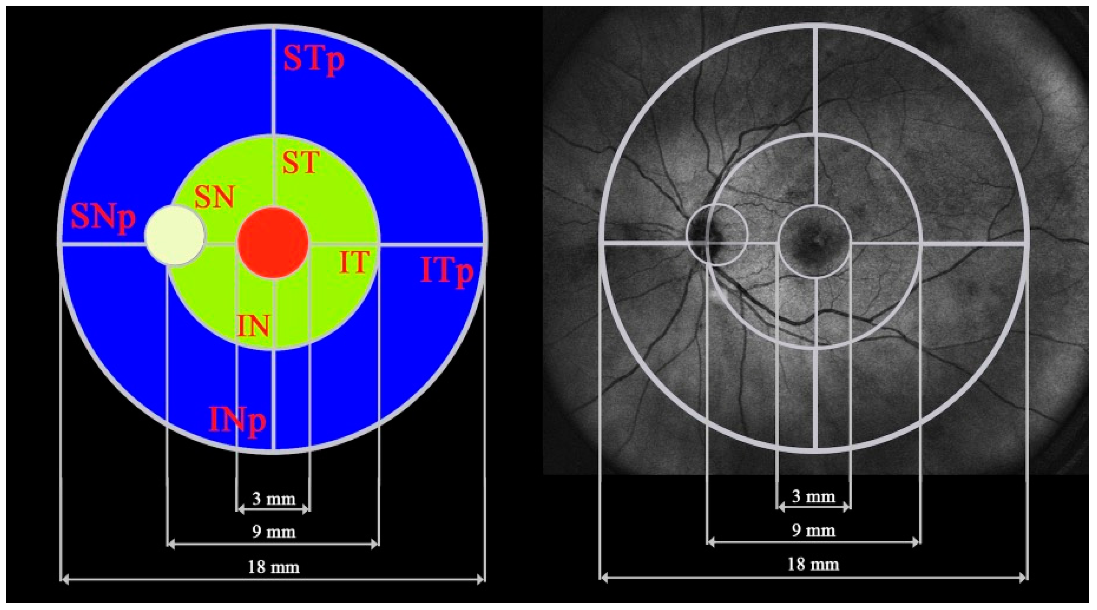 Diagnostics 14 01114 g001