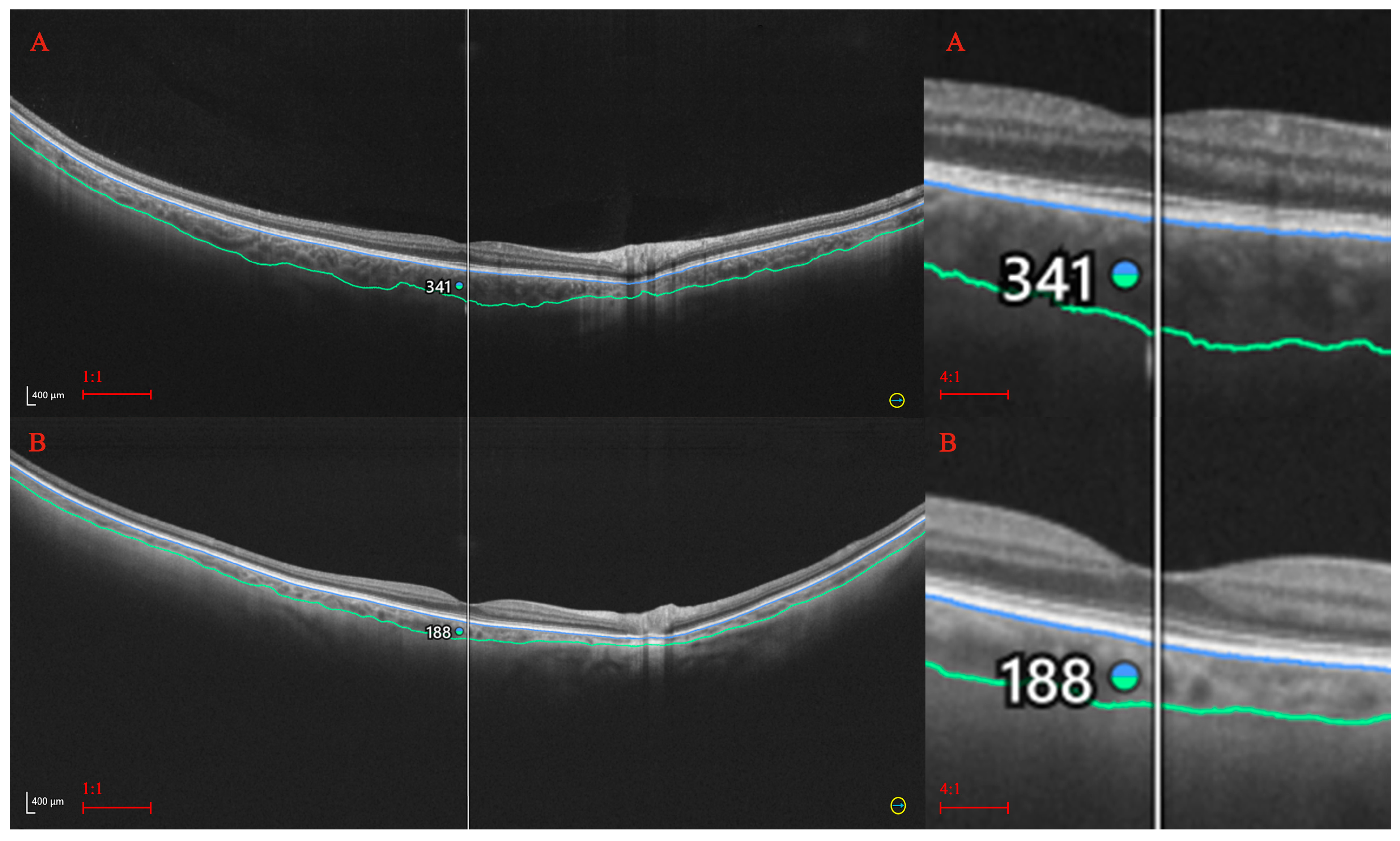 Diagnostics 14 01114 g002