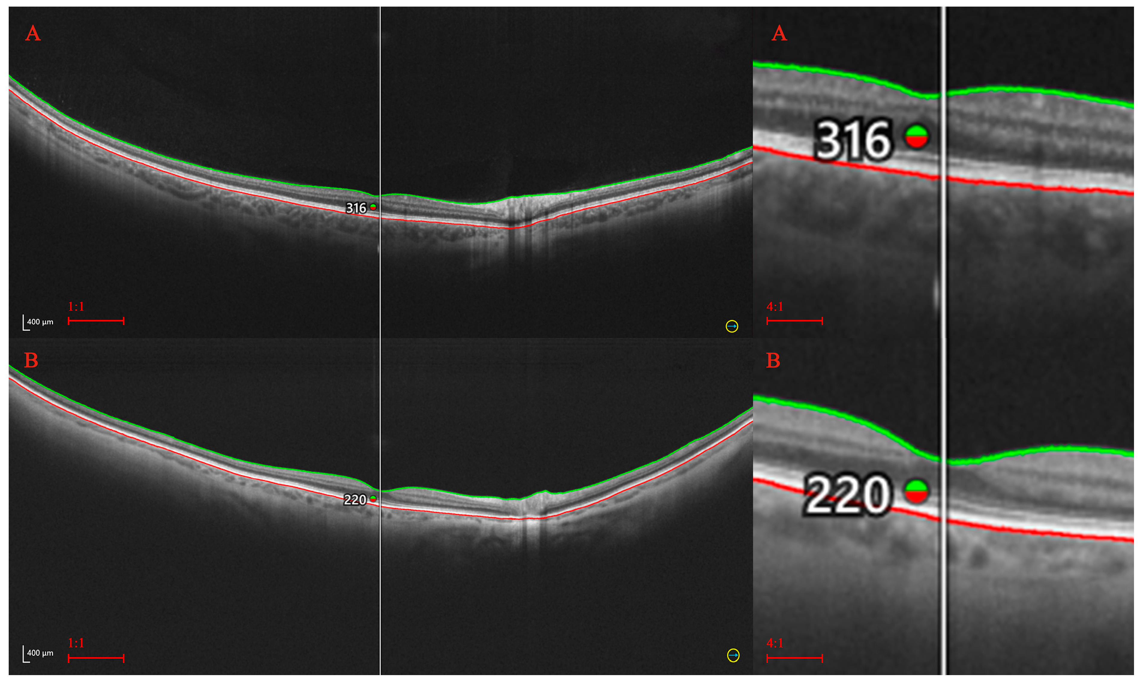 Diagnostics 14 01114 g003