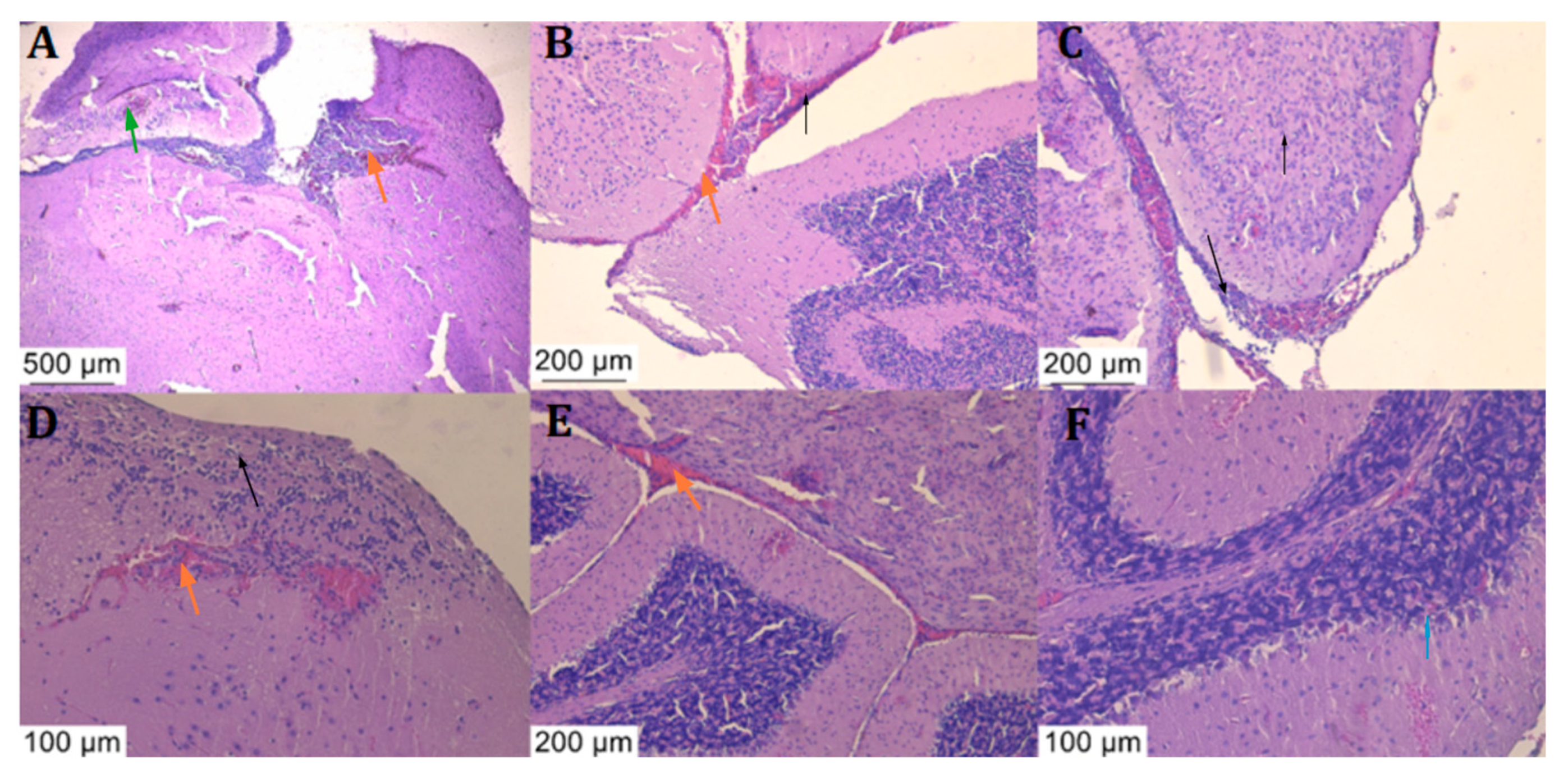 Diagnostics 14 01116 g006
