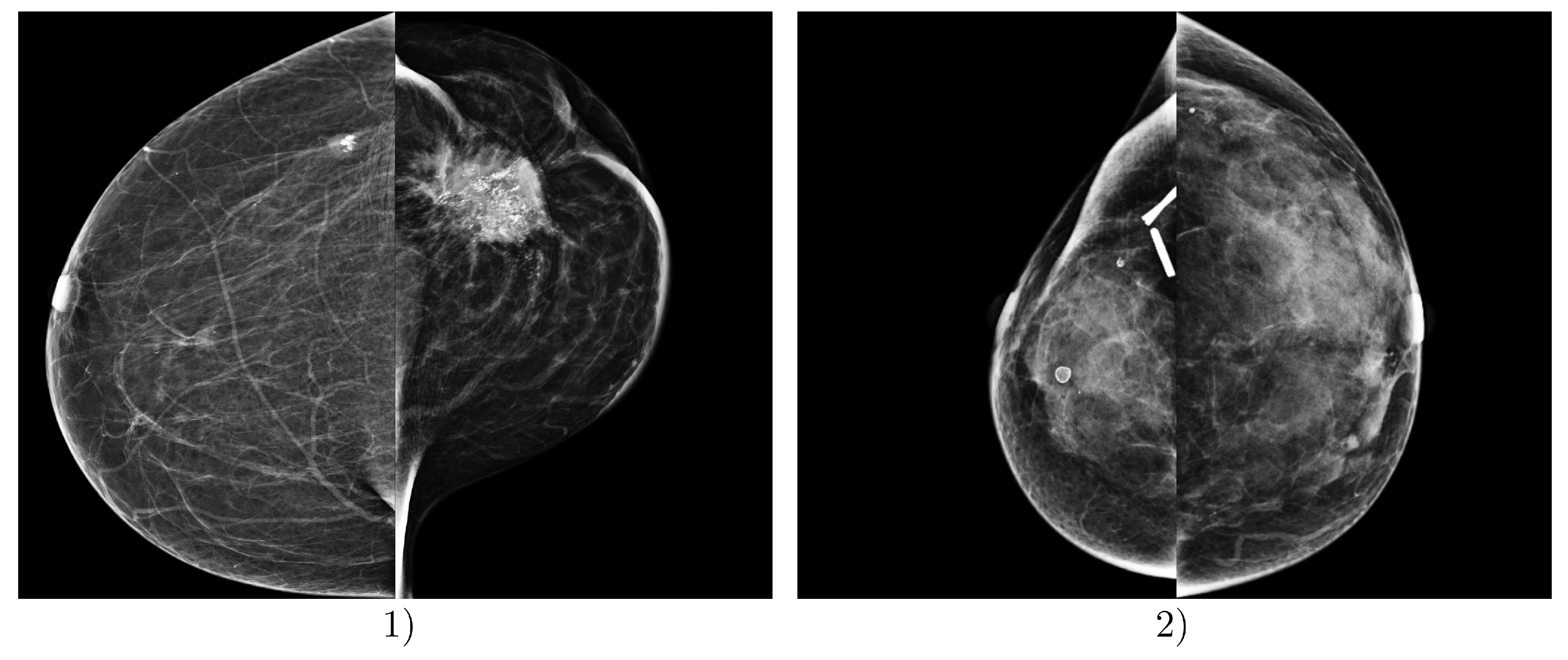 Diagnostics 14 01117 g007