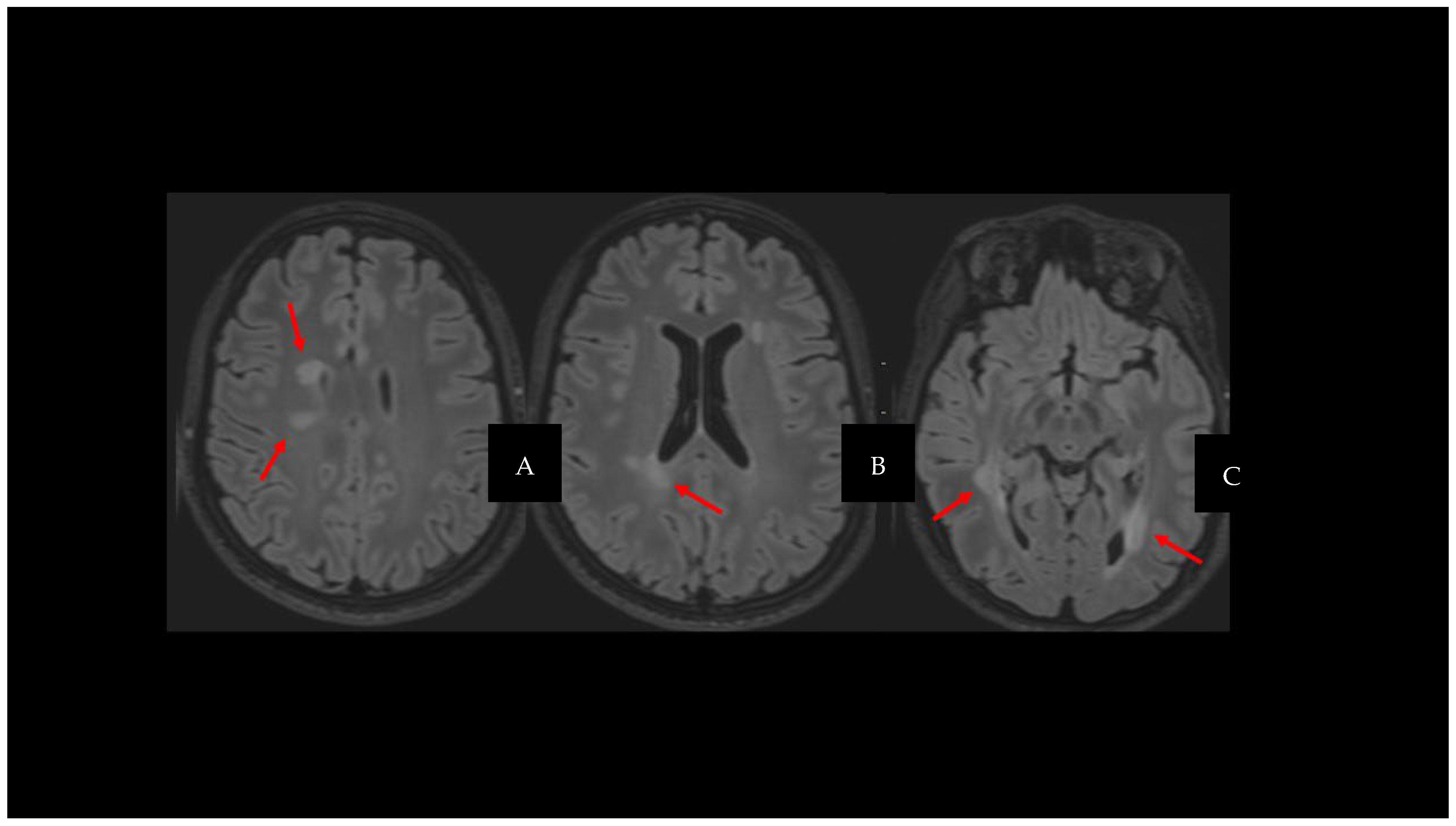 Diagnostics 14 01120 g001