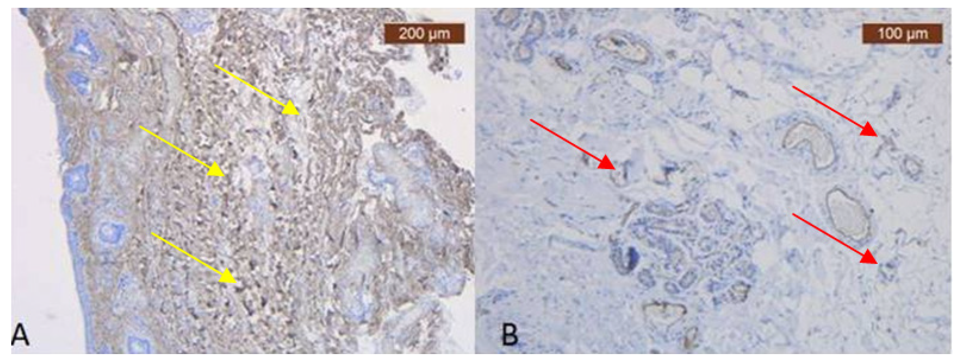 Diagnostics 14 01126 g006