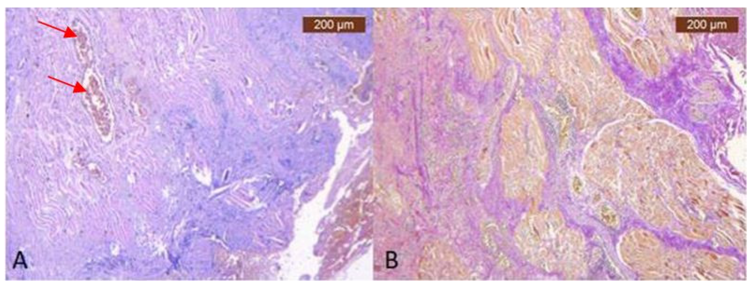 Diagnostics 14 01126 g007