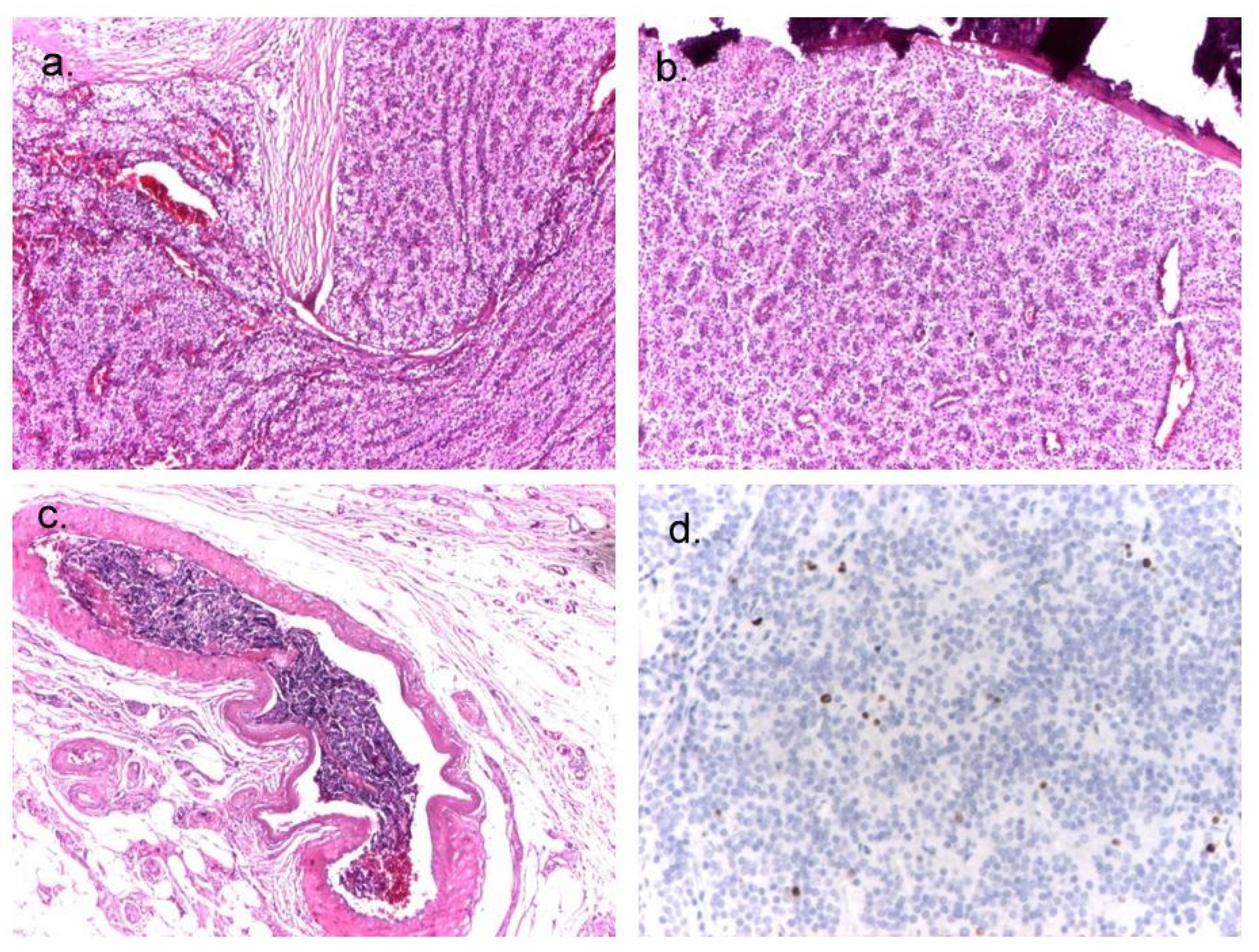 Diagnostics 14 01127 g004