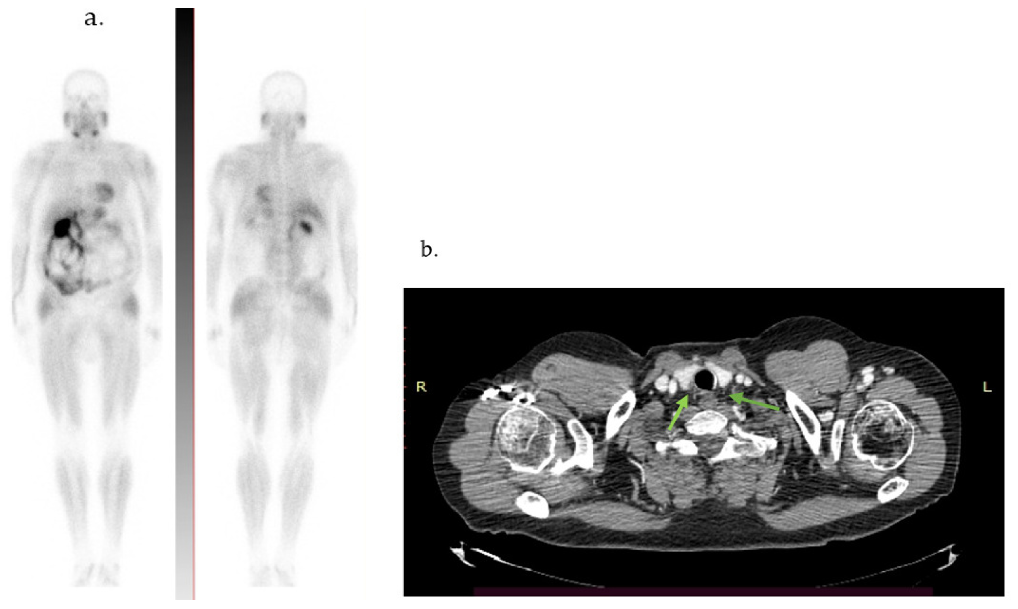 Diagnostics 14 01127 g005