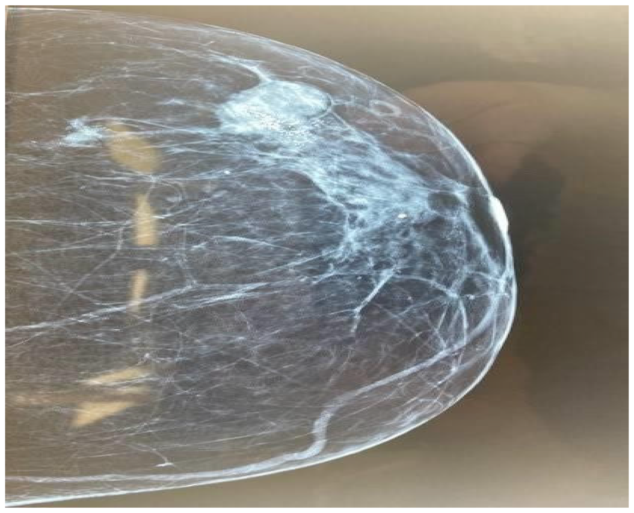 Diagnostics 14 01133 g001