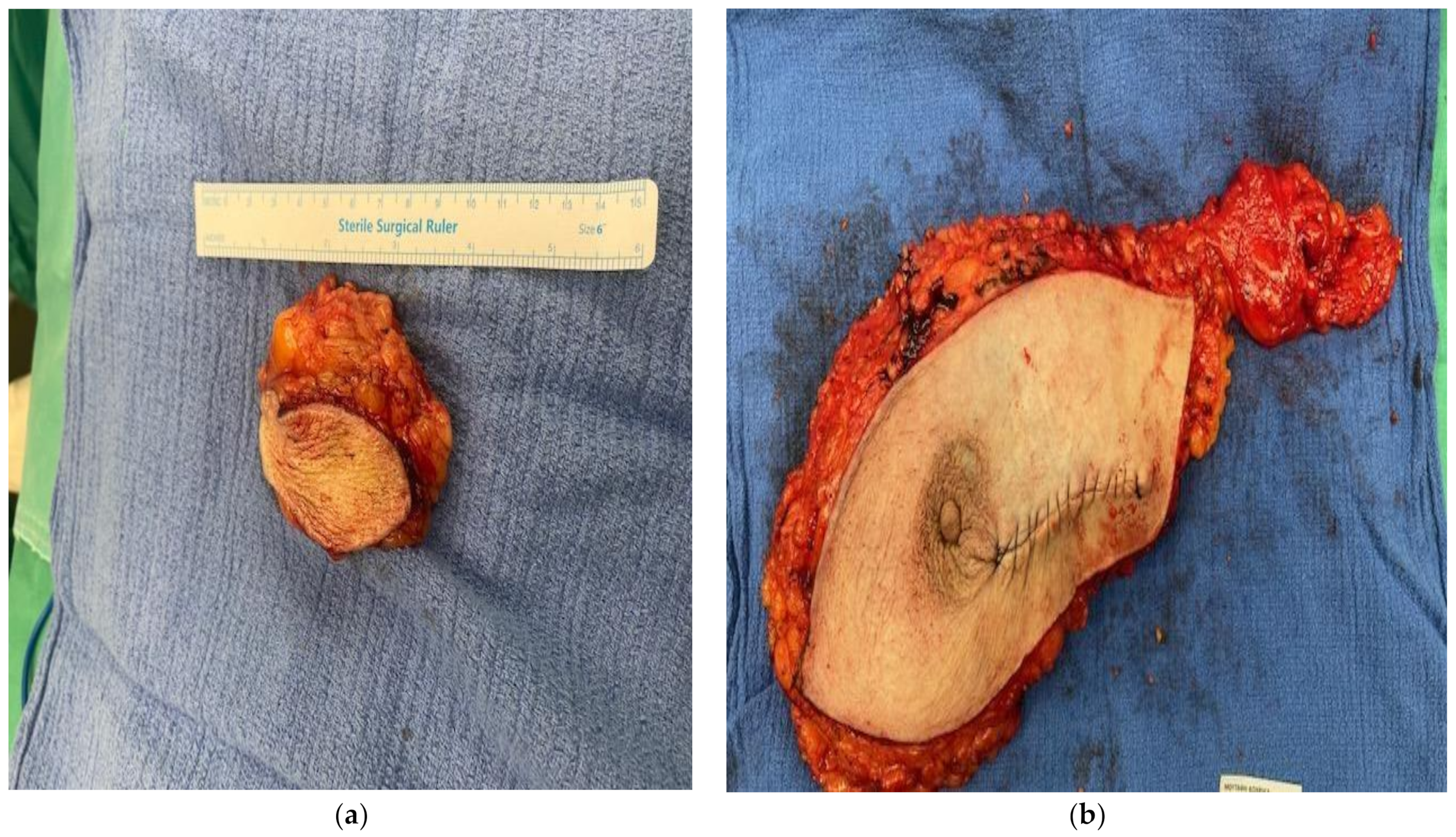 Diagnostics 14 01133 g002