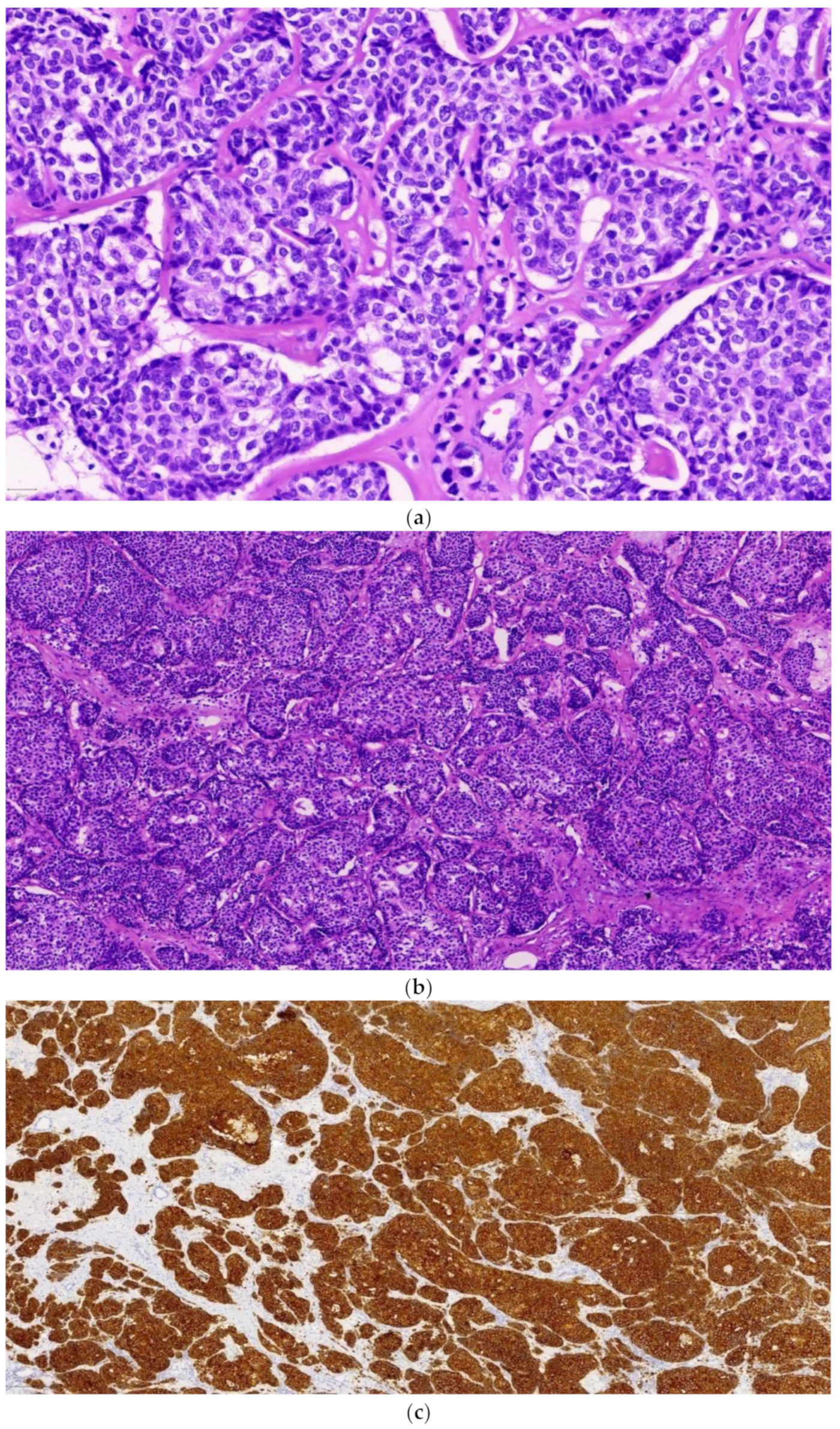 Diagnostics 14 01133 g003a