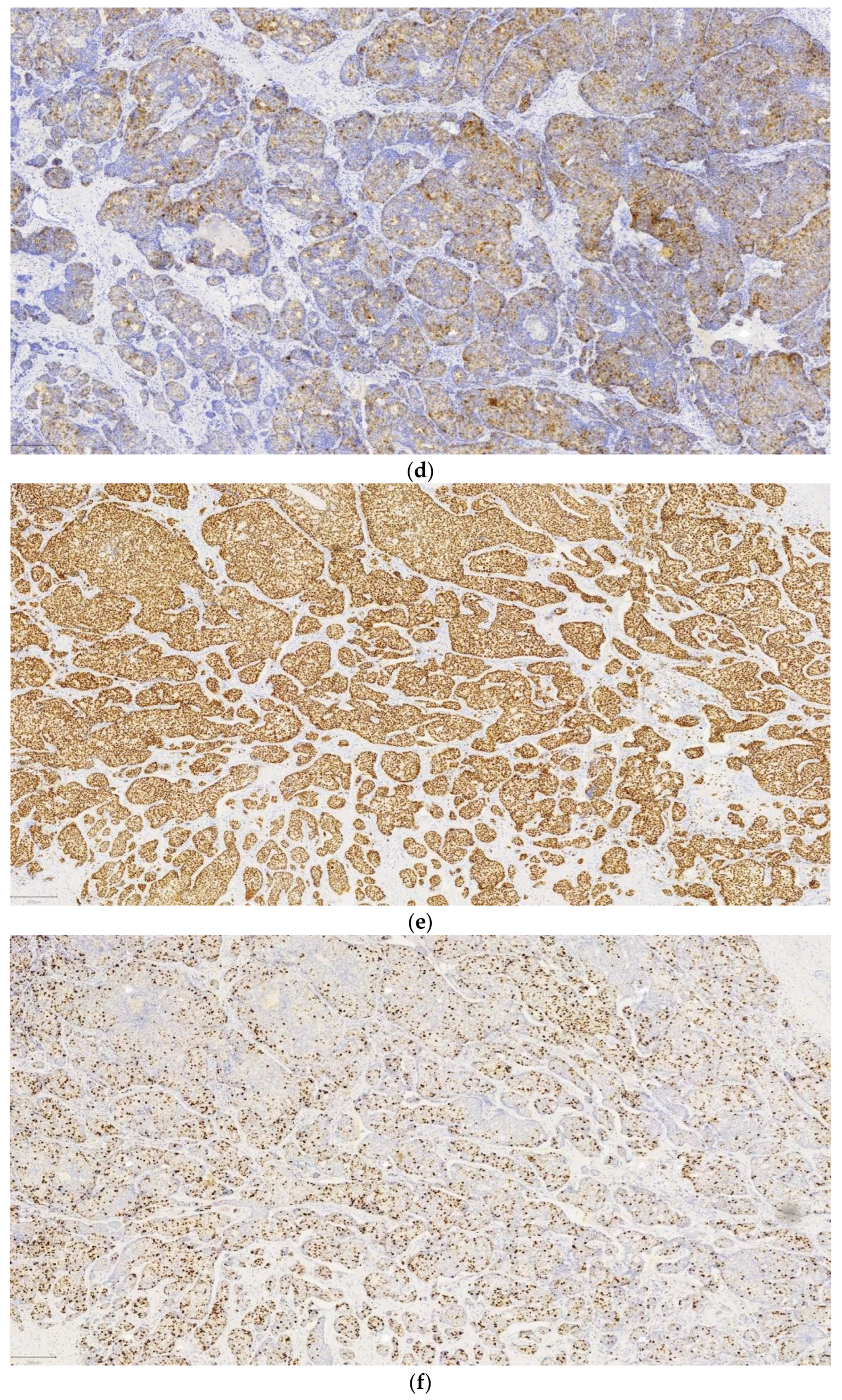 Diagnostics 14 01133 g003b