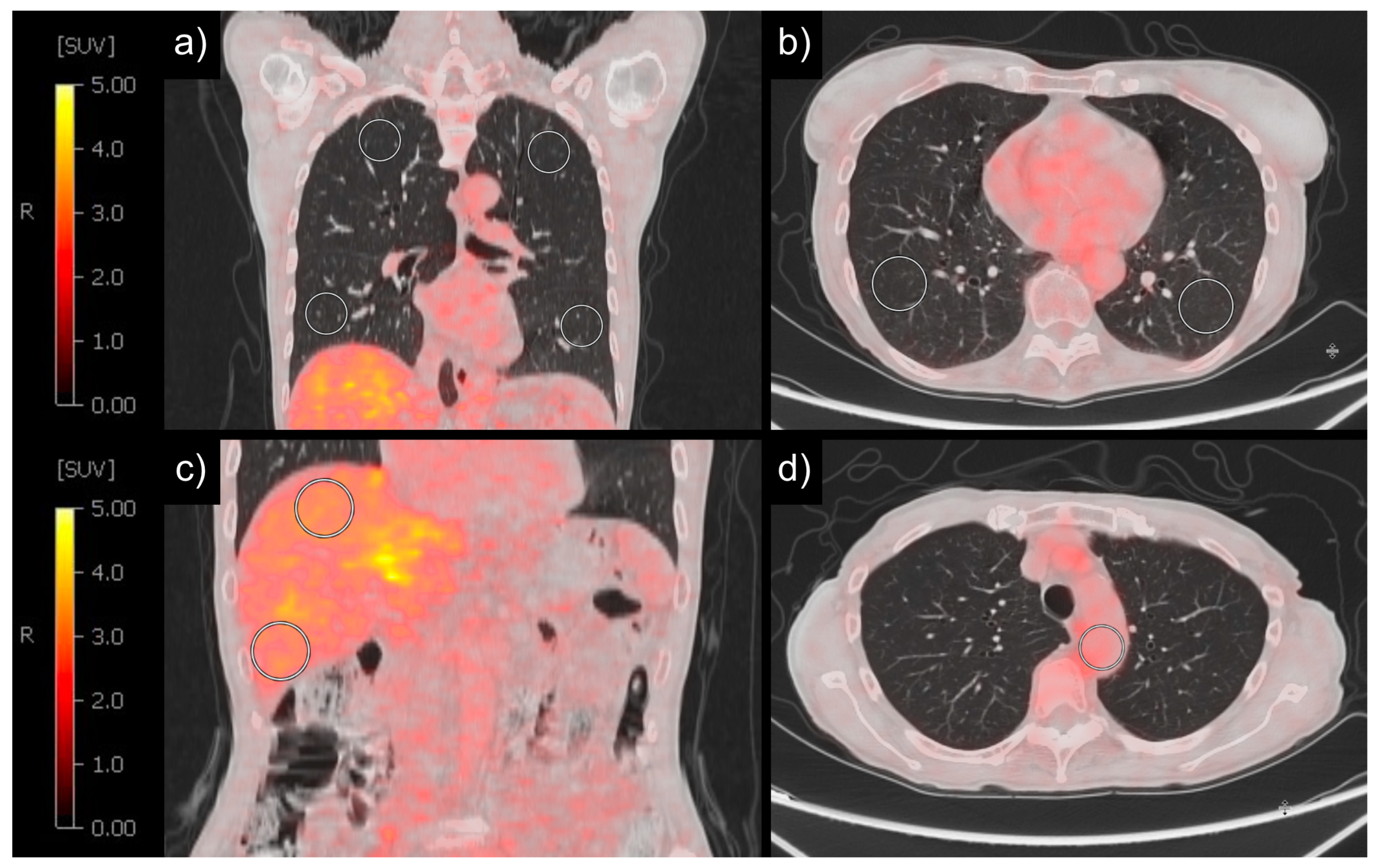 Diagnostics 14 01139 g001 Diagnostics 14 01139 g001