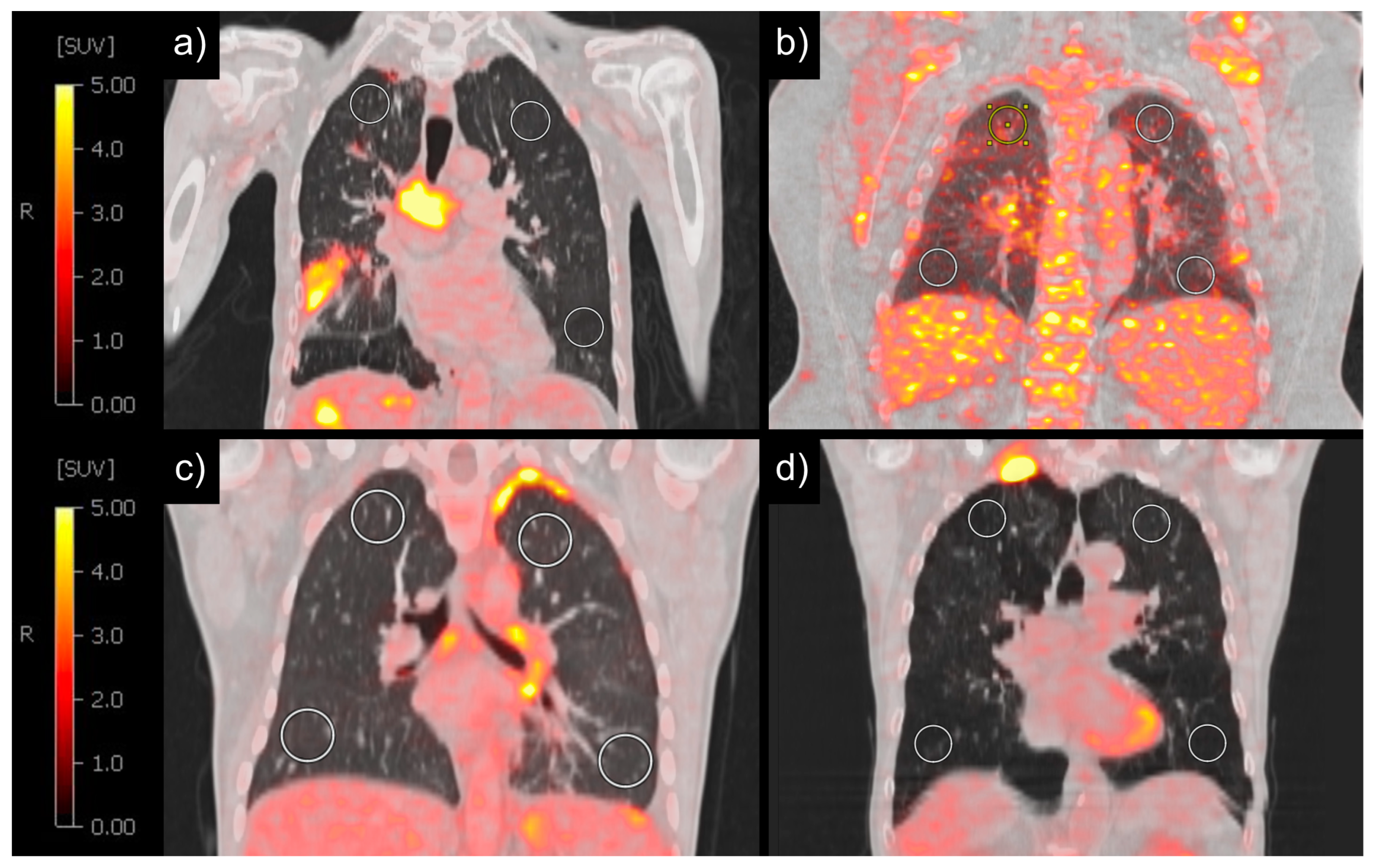 Diagnostics 14 01139 g004 Diagnostics 14 01139 g004