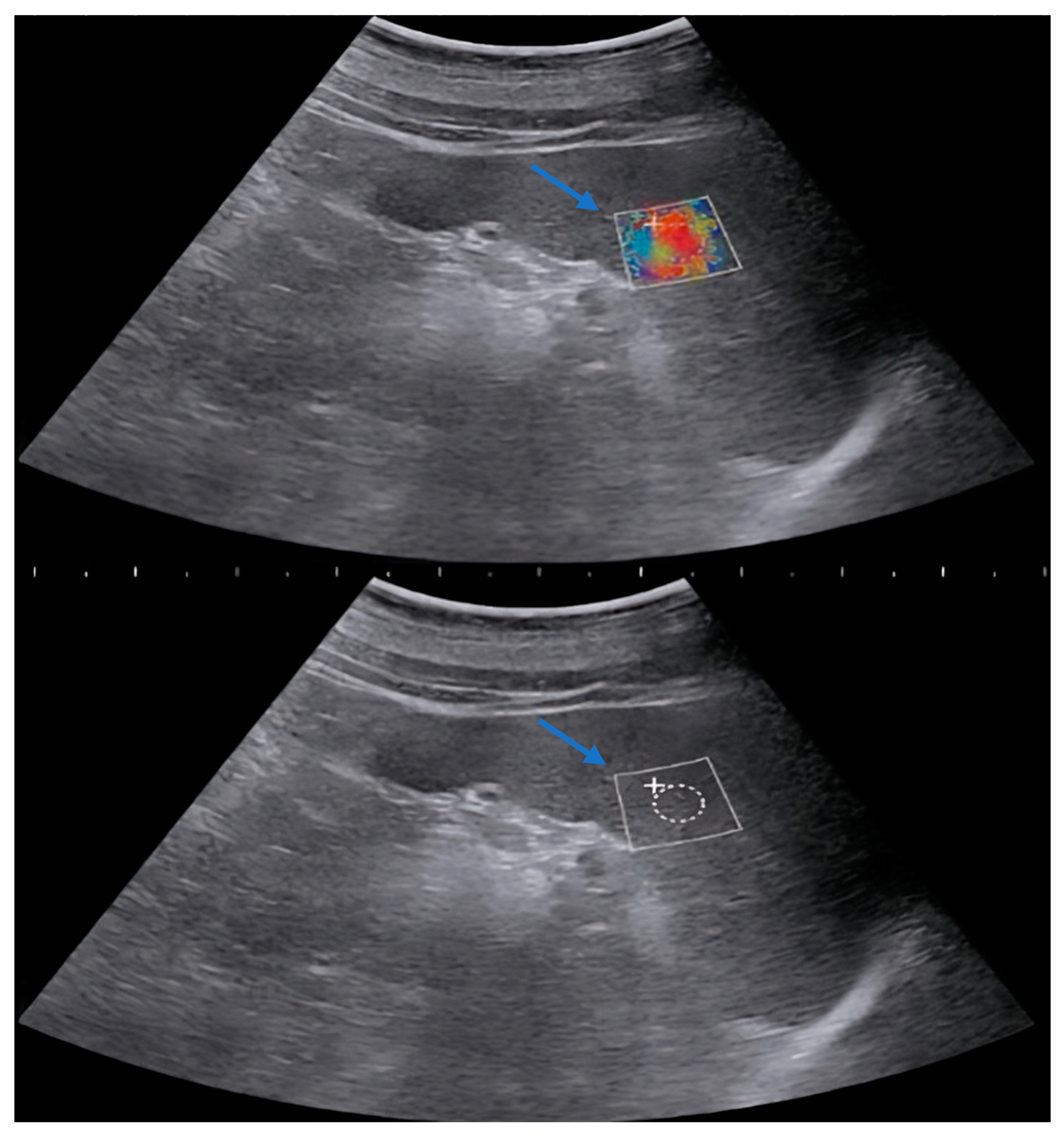 Diagnostics 14 01142 g001
