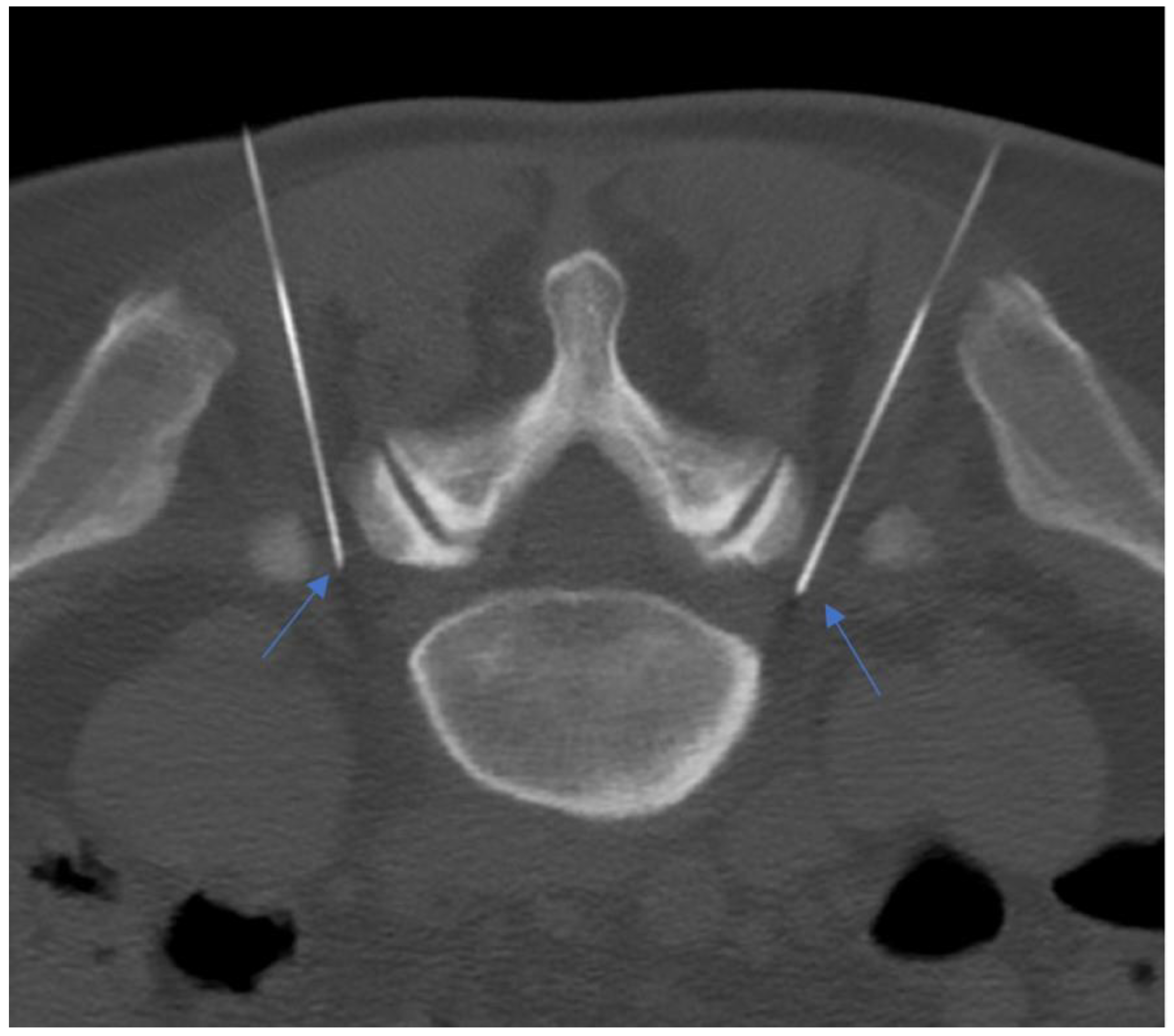 Diagnostics 14 01147 g012 Diagnostics 14 01147 g012