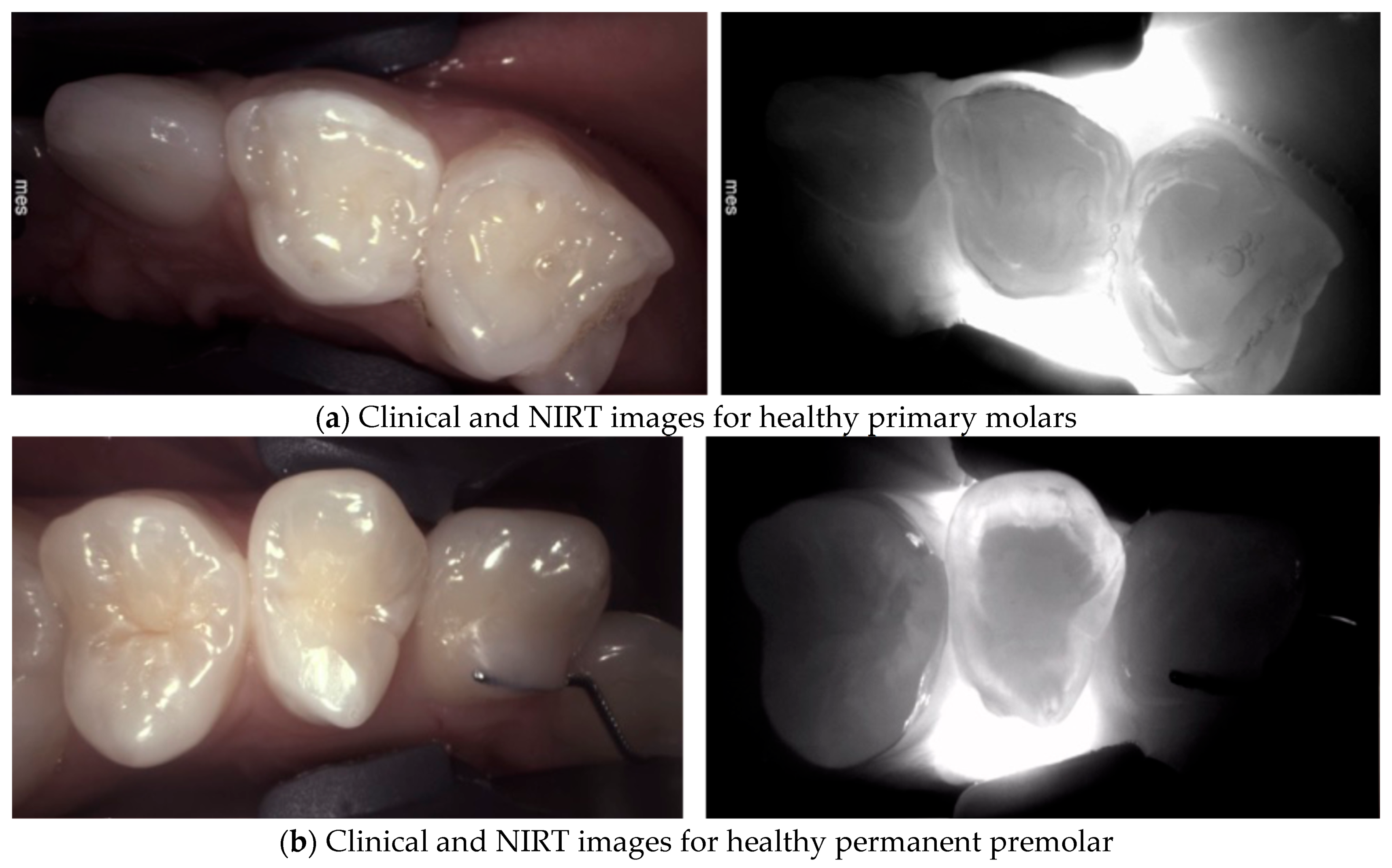 Diagnostics 14 01154 g001