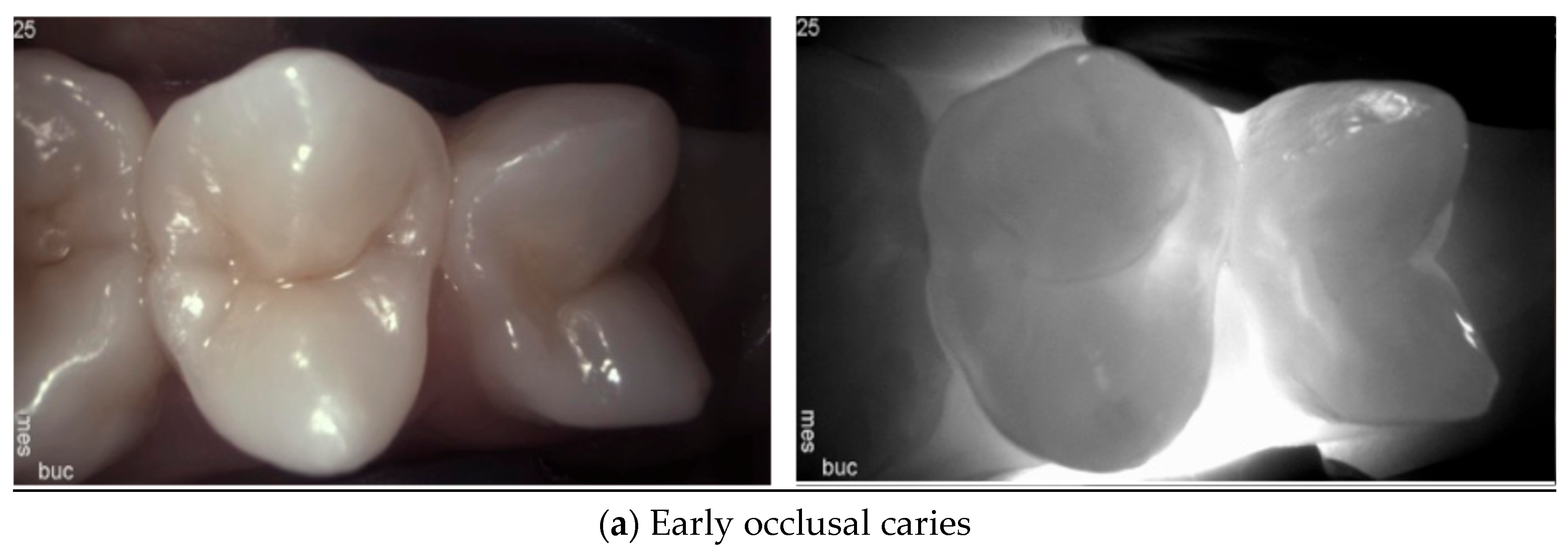 Diagnostics 14 01154 g002a
