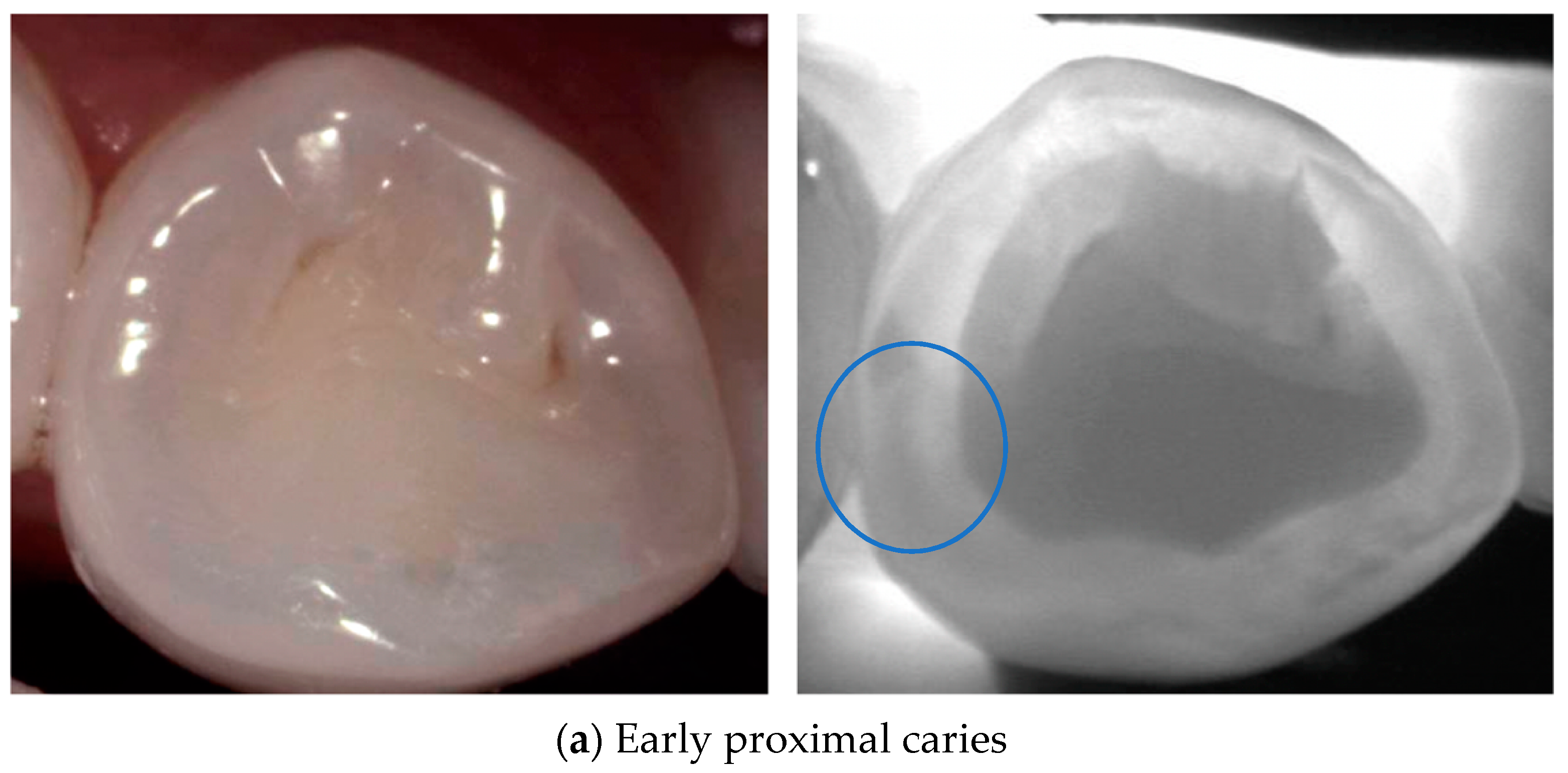 Diagnostics 14 01154 g003a